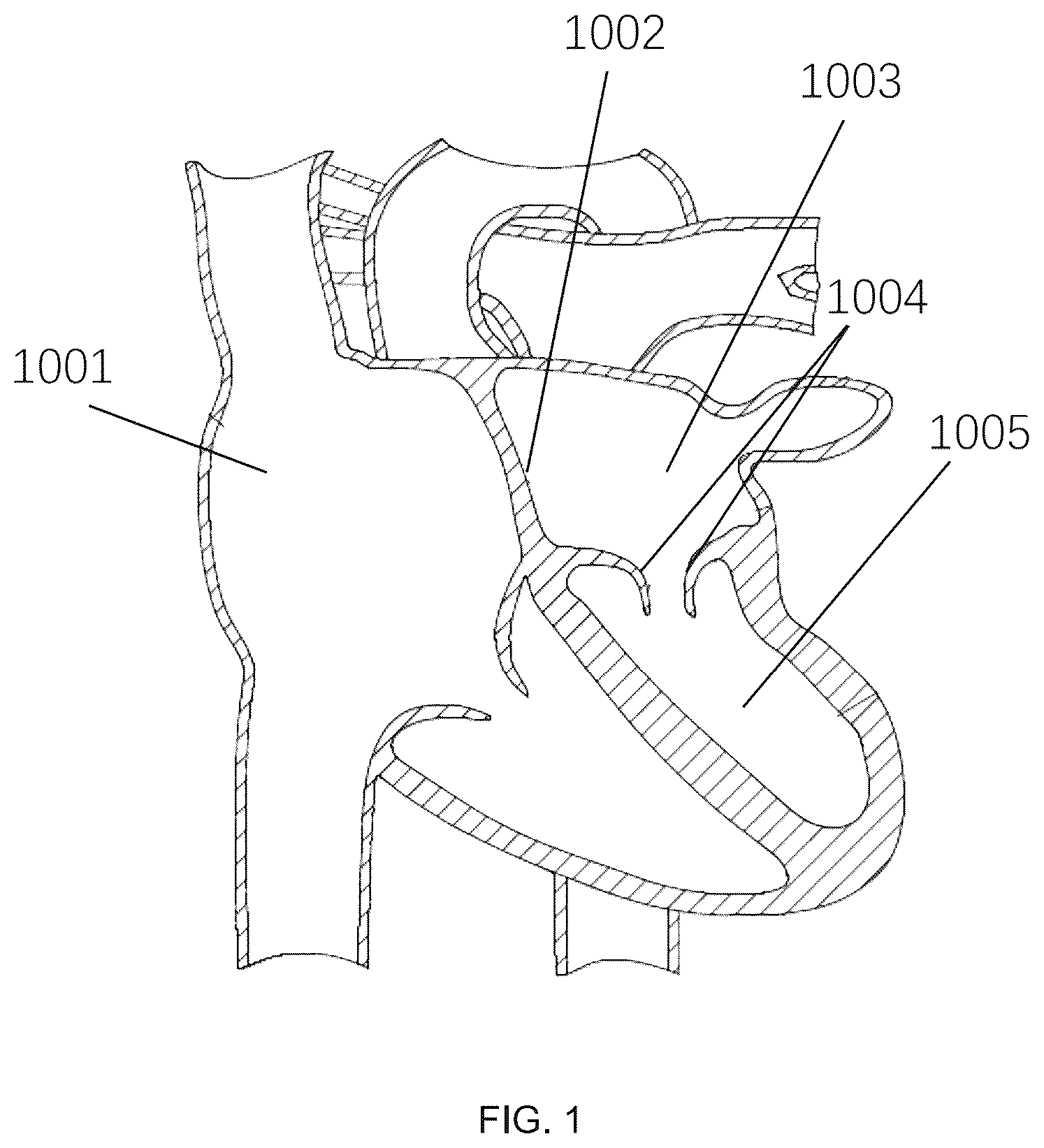 Patent US12551305 Figure 1 – Control method and associated apparatus for surgical assistance system
