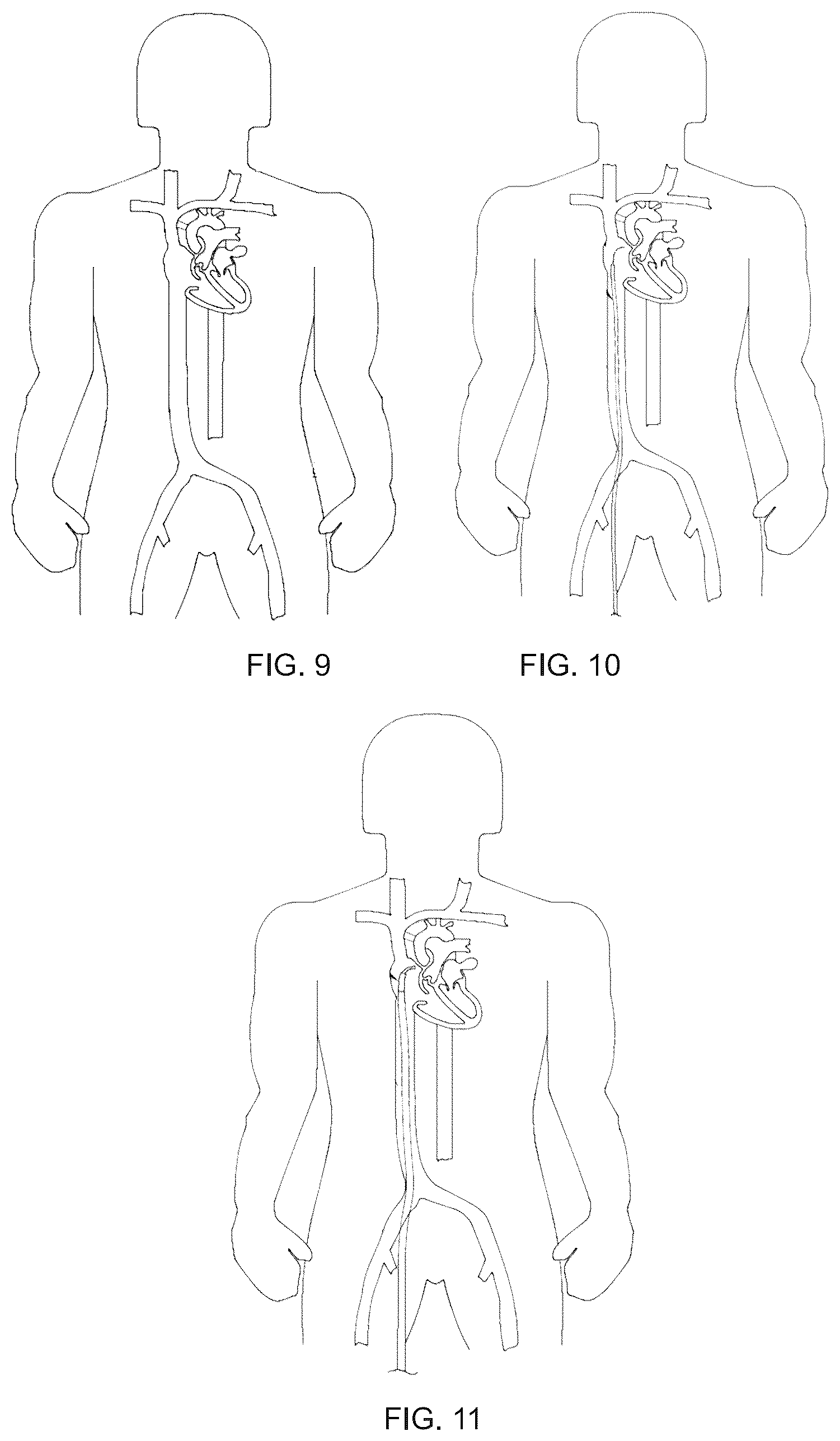 Patent US12551305 Figure 5 – Control method and associated apparatus for surgical assistance system