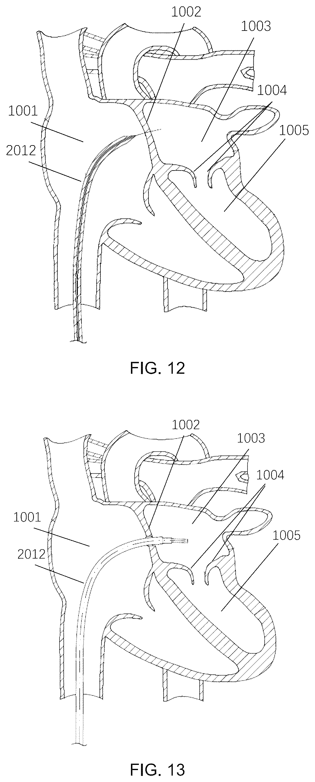 Patent US12551305 Figure 6 – Control method and associated apparatus for surgical assistance system