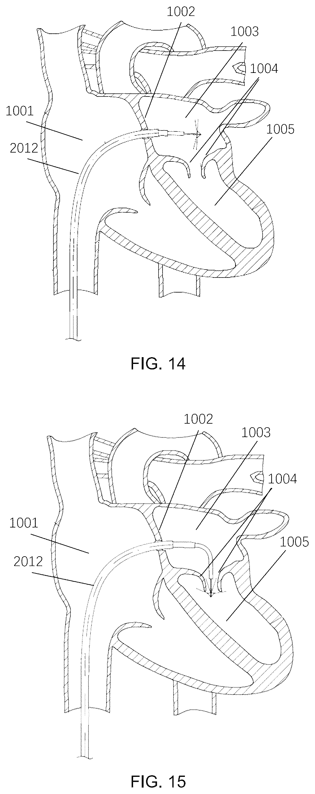 Patent US12551305 Figure 7 – Control method and associated apparatus for surgical assistance system