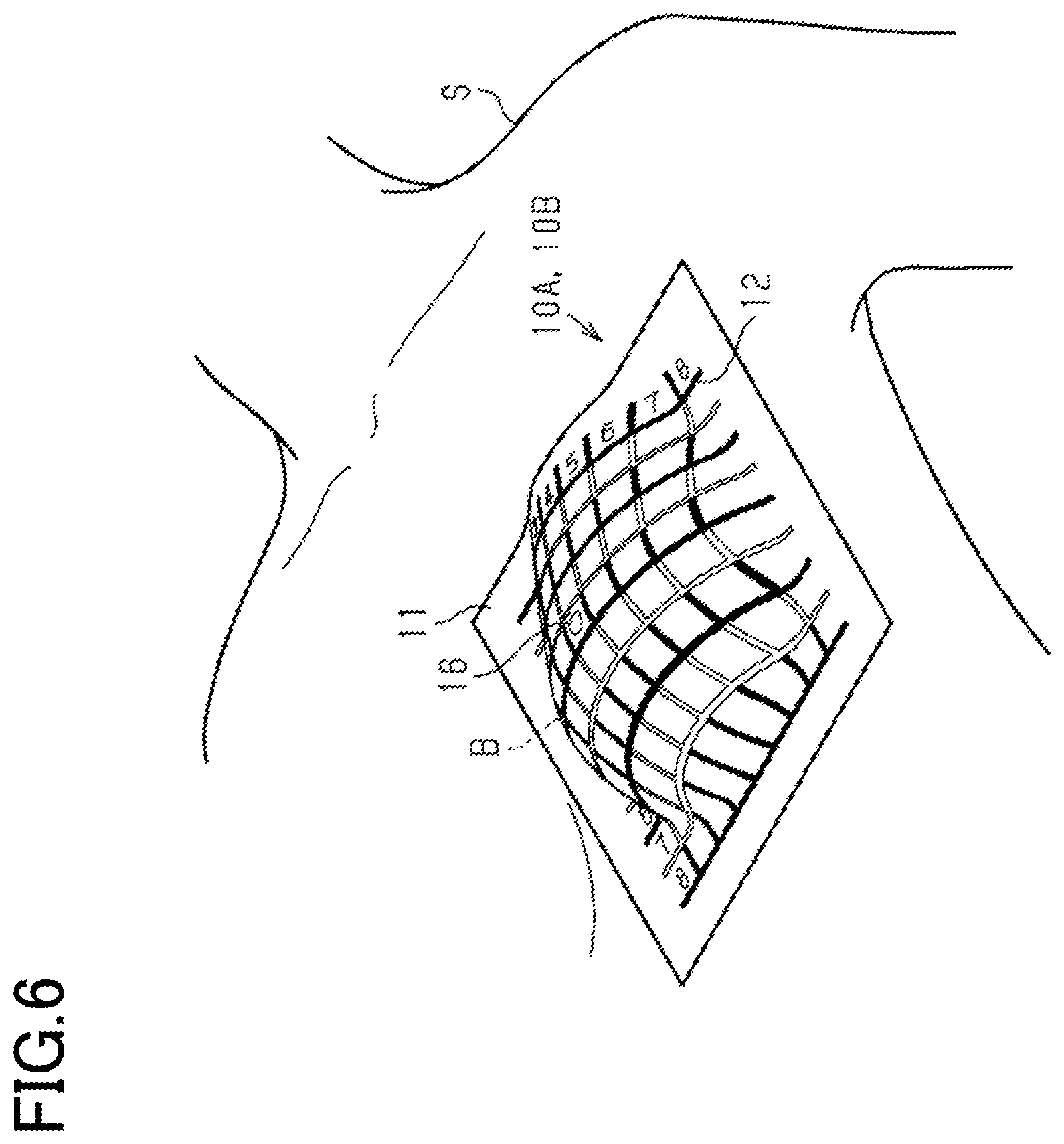 Patent US12551314 Figure 3 – Examination marker