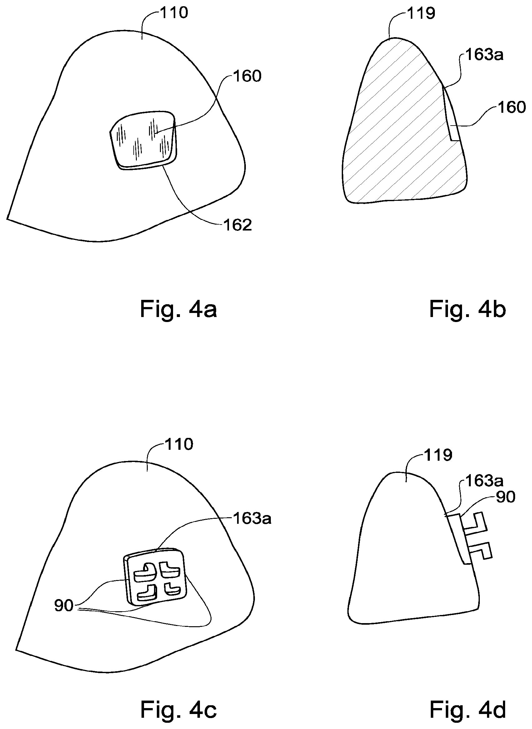 Patent US12551318 Figure 4 – Method, system and model for indirect bonding