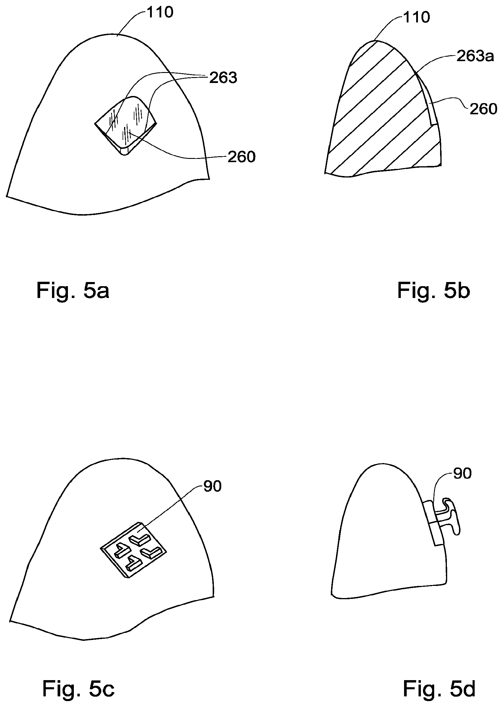 Patent US12551318 Figure 6 – Method, system and model for indirect bonding