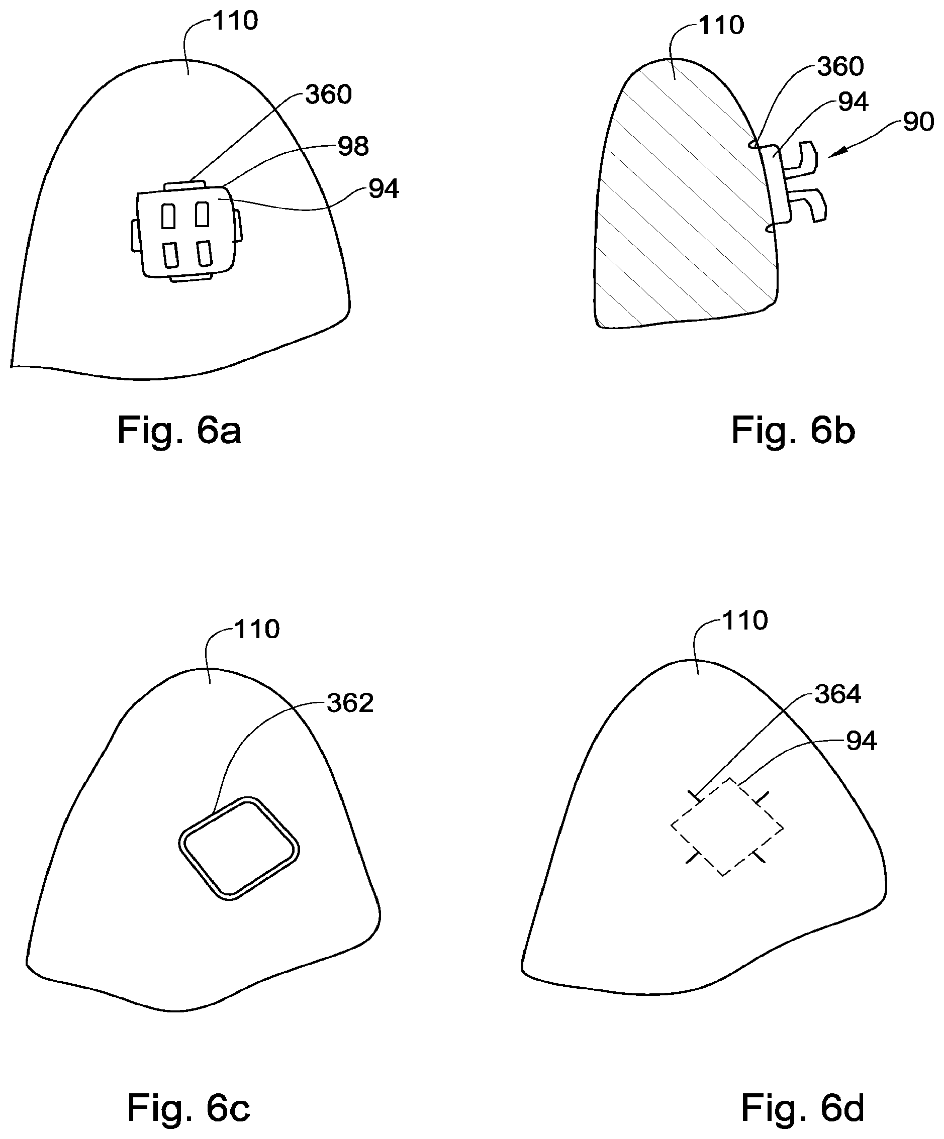 Patent US12551318 Figure 7 – Method, system and model for indirect bonding