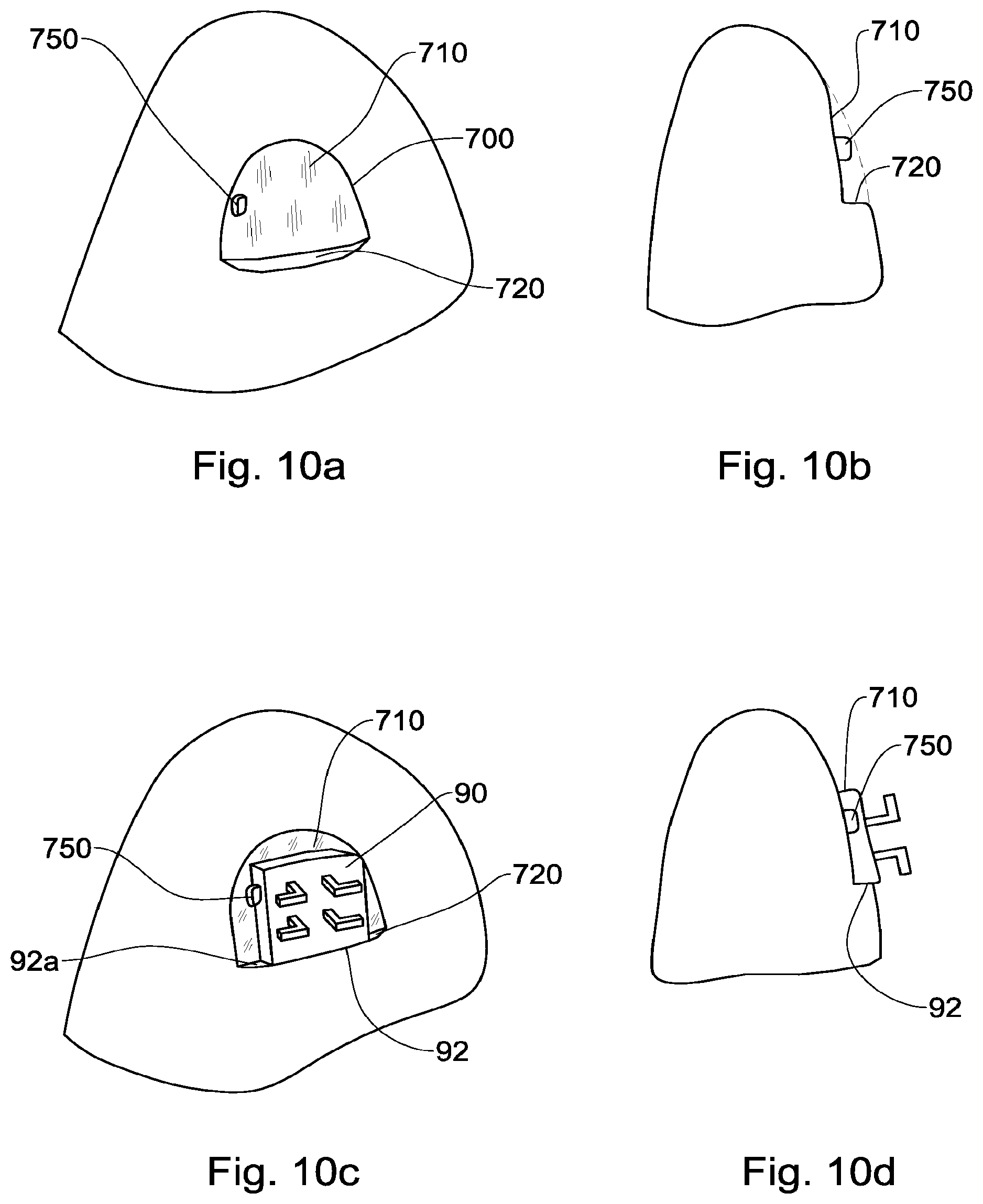 Patent US12551318 Figure 12 – Method, system and model for indirect bonding