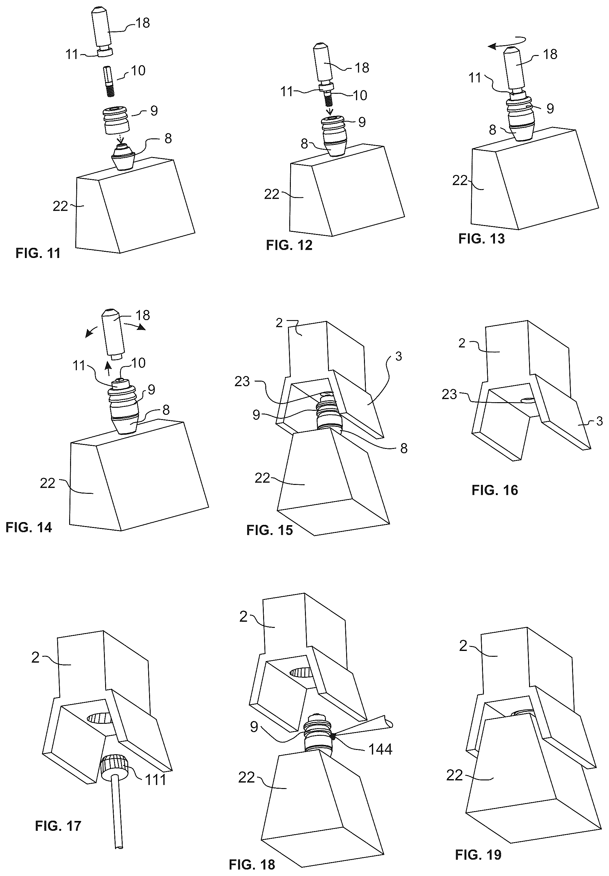 Patent US12551319 Figure 6 – Screw-attached pick-up dental coping system and methods
