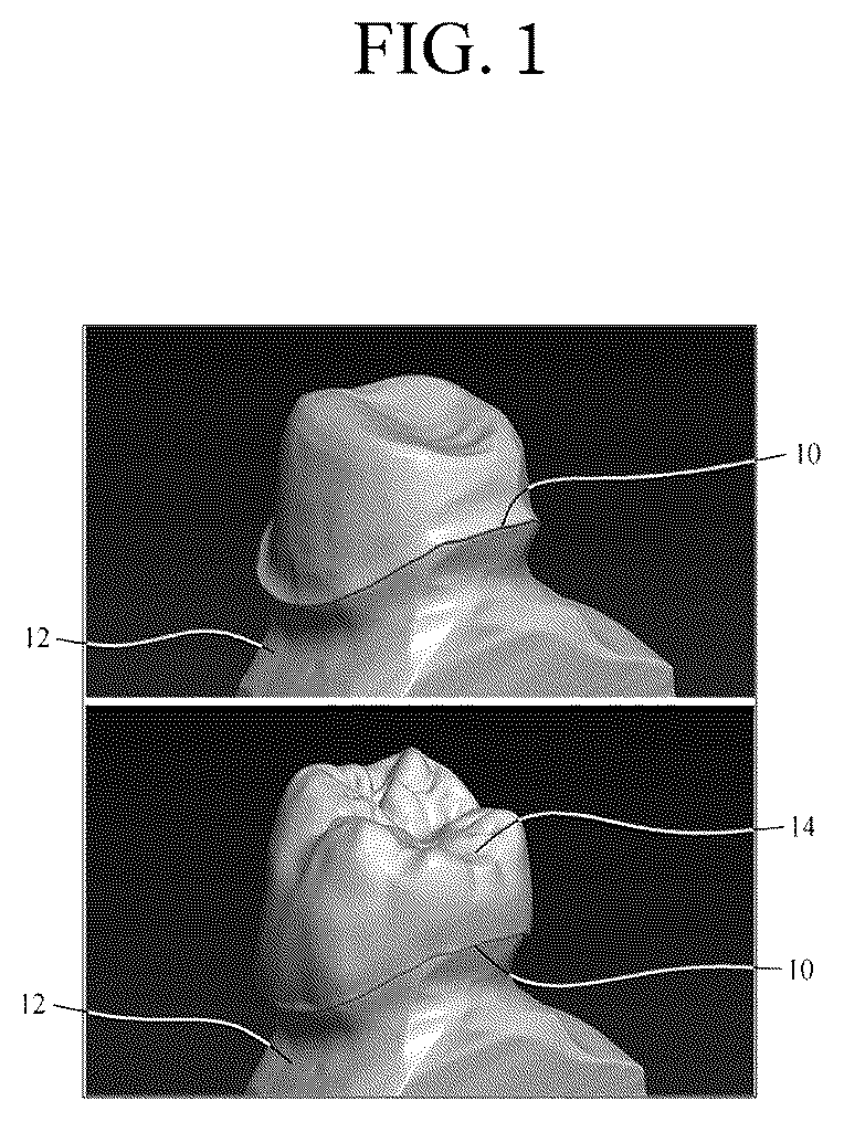 Patent US12551320 Figure 1 – Method for selecting margin line point, and dental cad device therefor