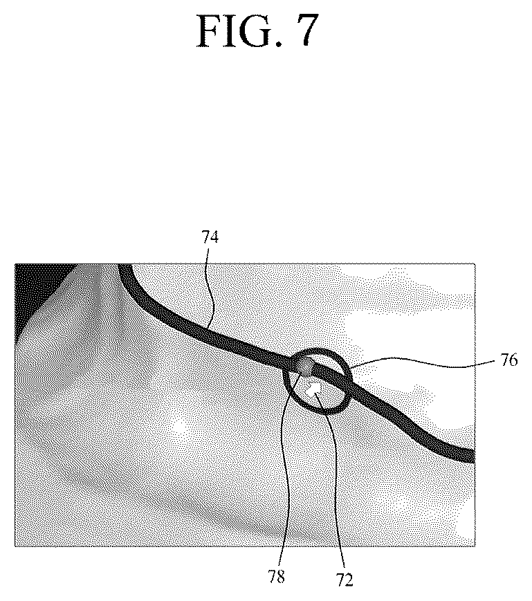 Patent US12551320 Figure 7 – Method for selecting margin line point, and dental cad device therefor