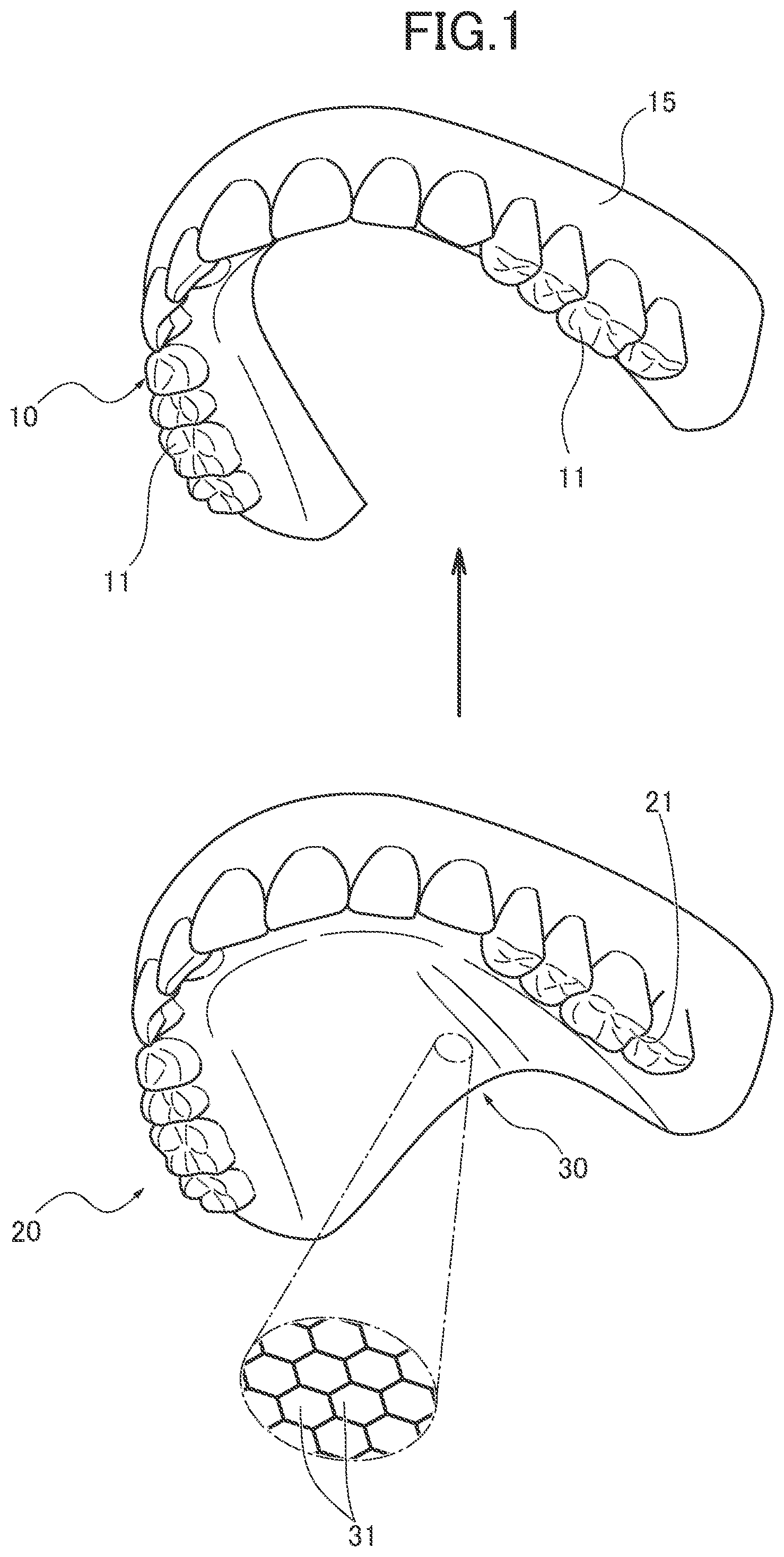 Patent US12551321 Figure 1 – Dental intraoral device and manufacturing method thereof