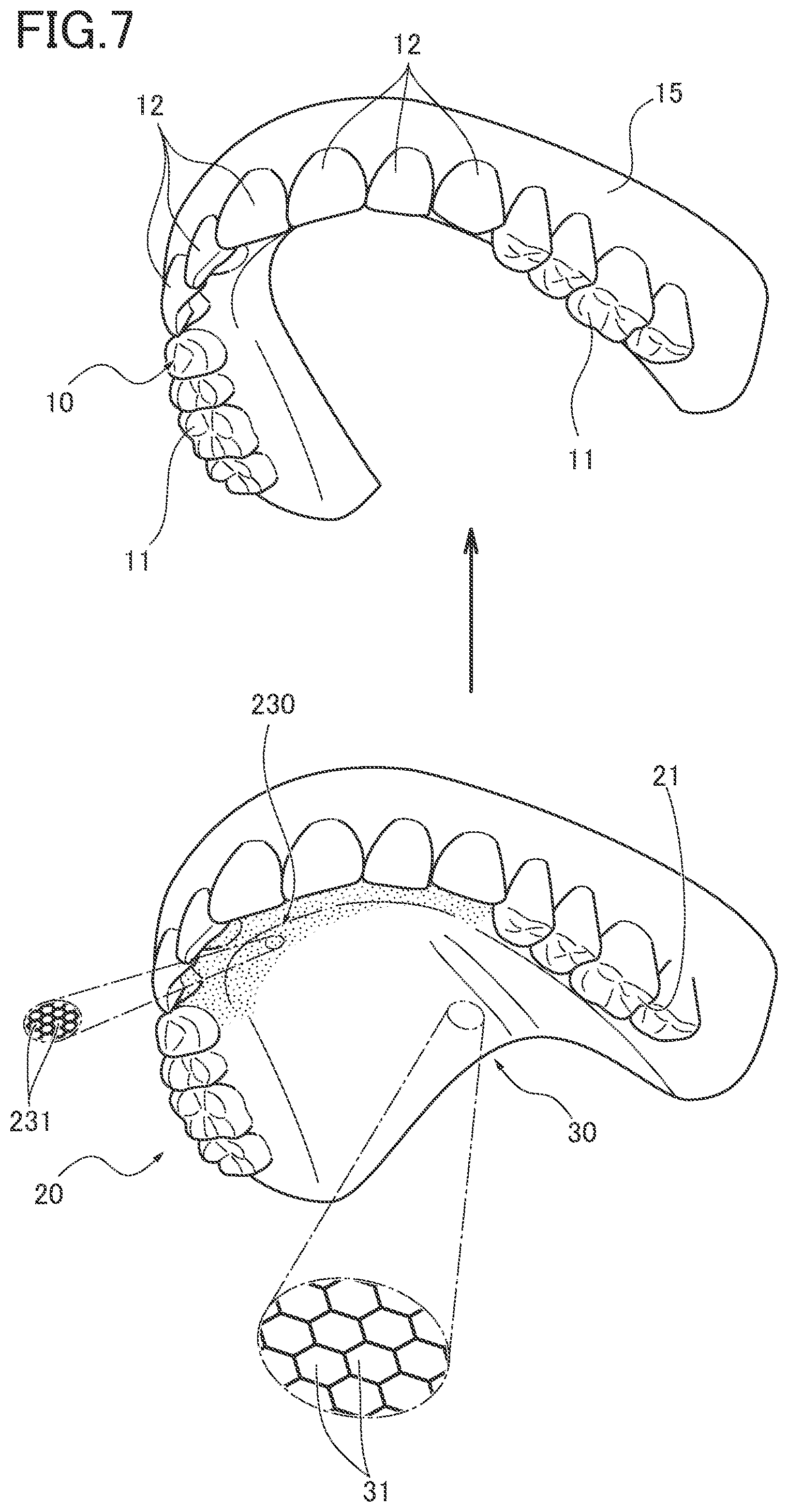 Patent US12551321 Figure 7 – Dental intraoral device and manufacturing method thereof