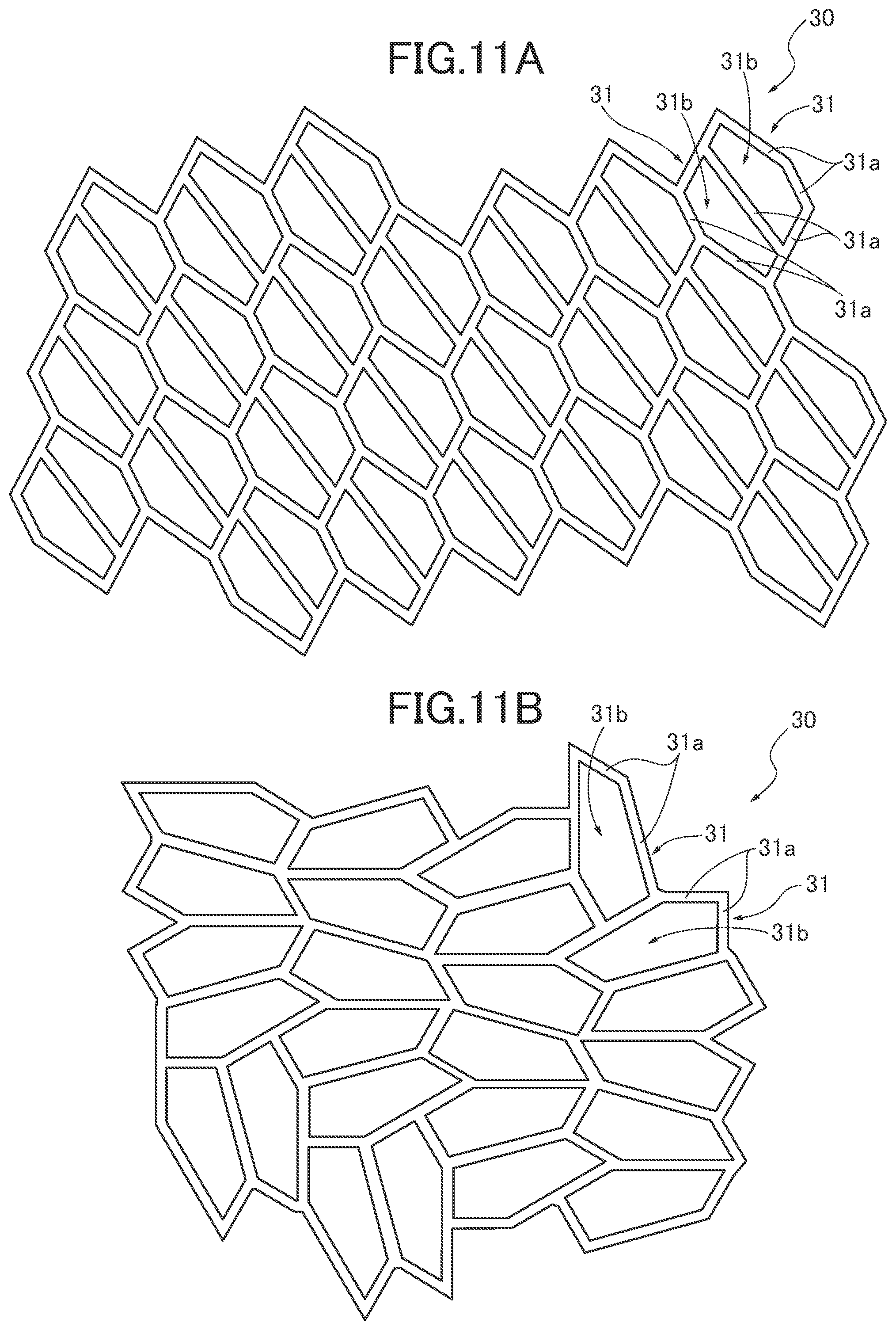Patent US12551321 Figure 11 – Dental intraoral device and manufacturing method thereof
