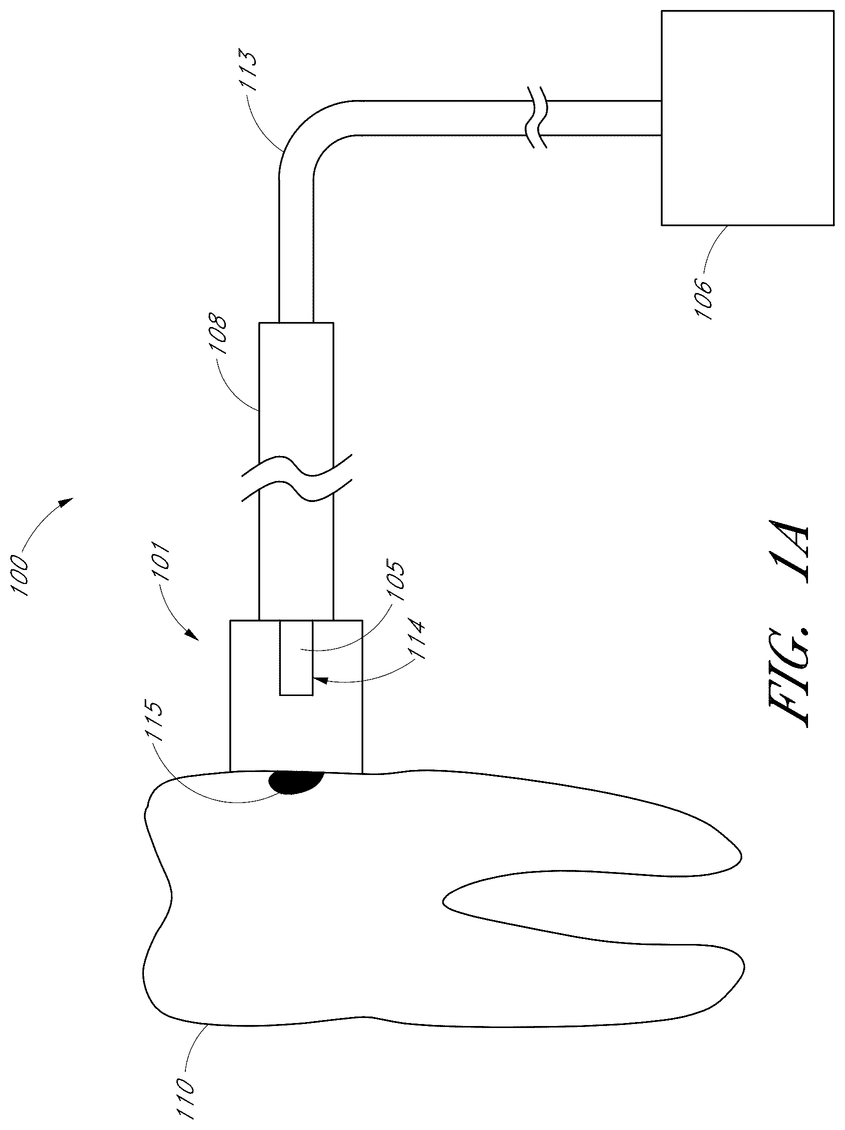 Patent US12551322 Figure 1 – Apparatus and methods for cleaning teeth