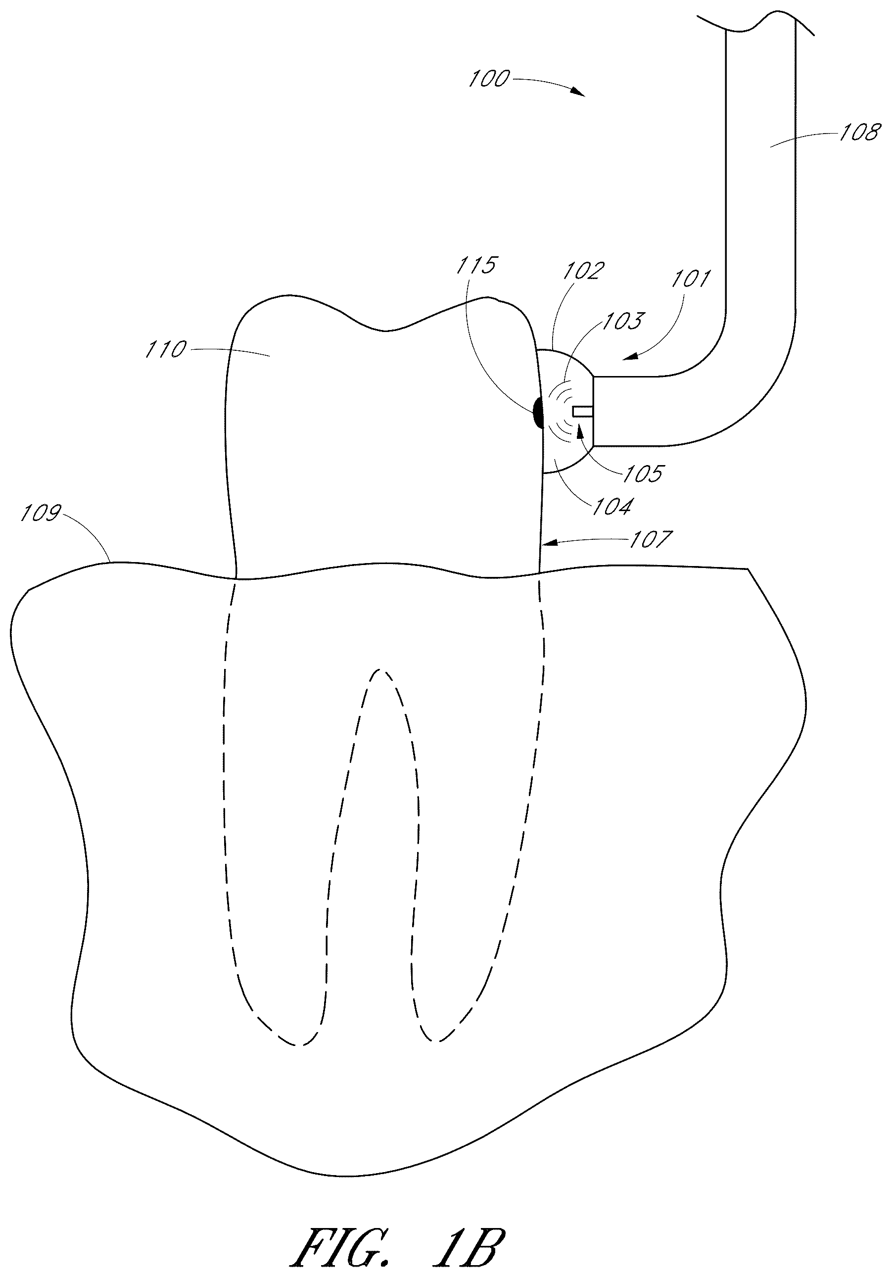 Patent US12551322 Figure 2 – Apparatus and methods for cleaning teeth