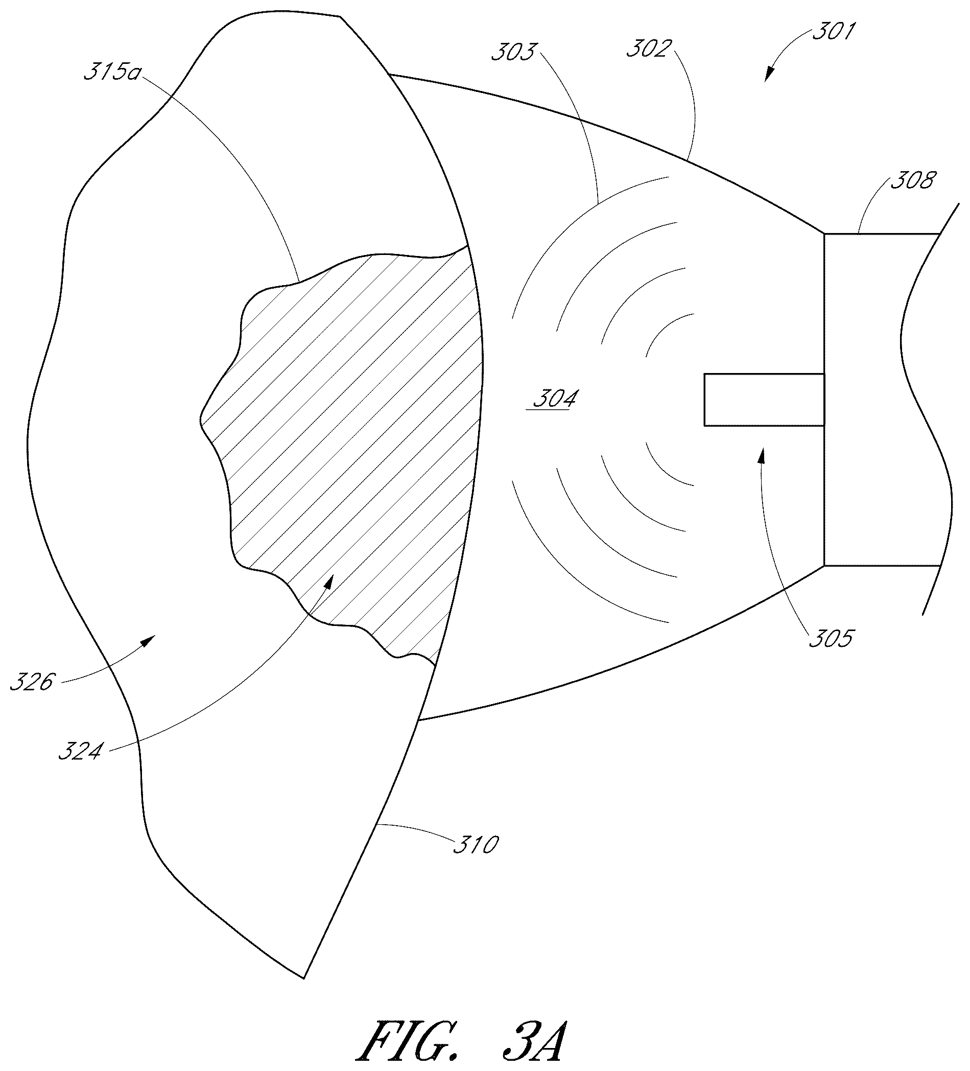Patent US12551322 Figure 4 – Apparatus and methods for cleaning teeth