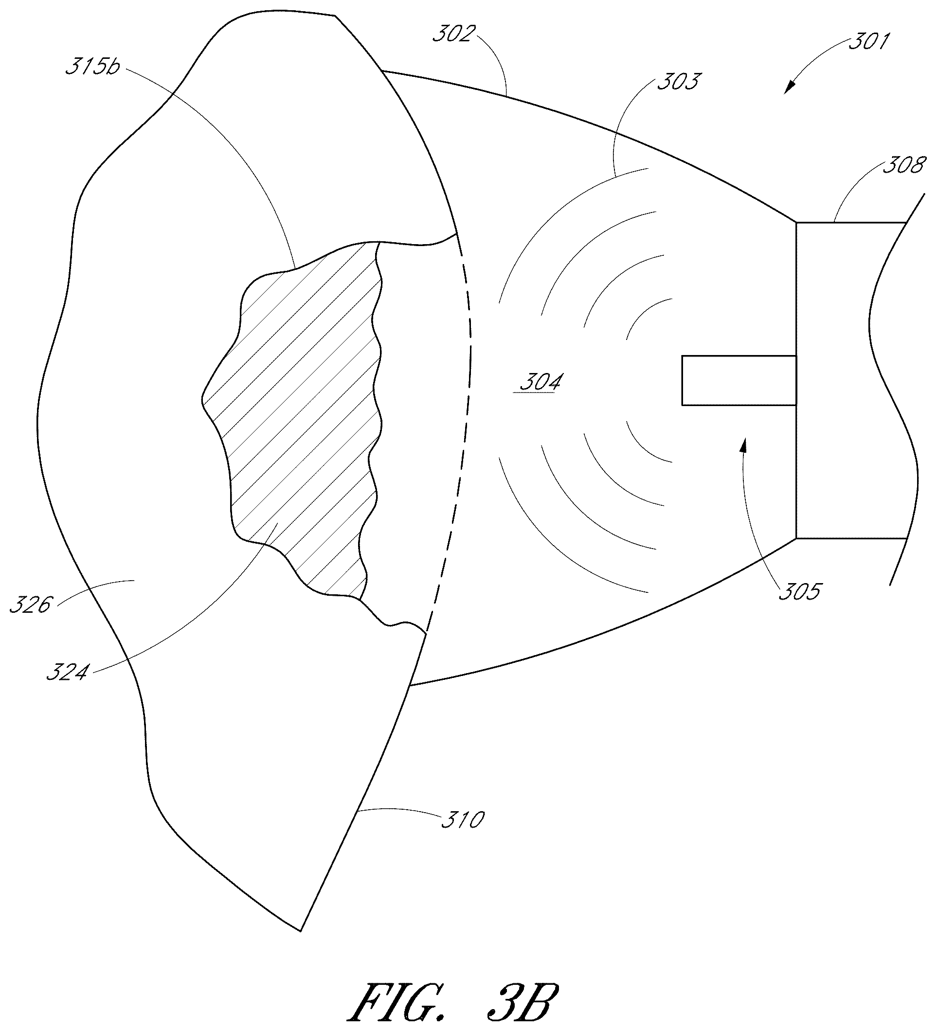 Patent US12551322 Figure 5 – Apparatus and methods for cleaning teeth