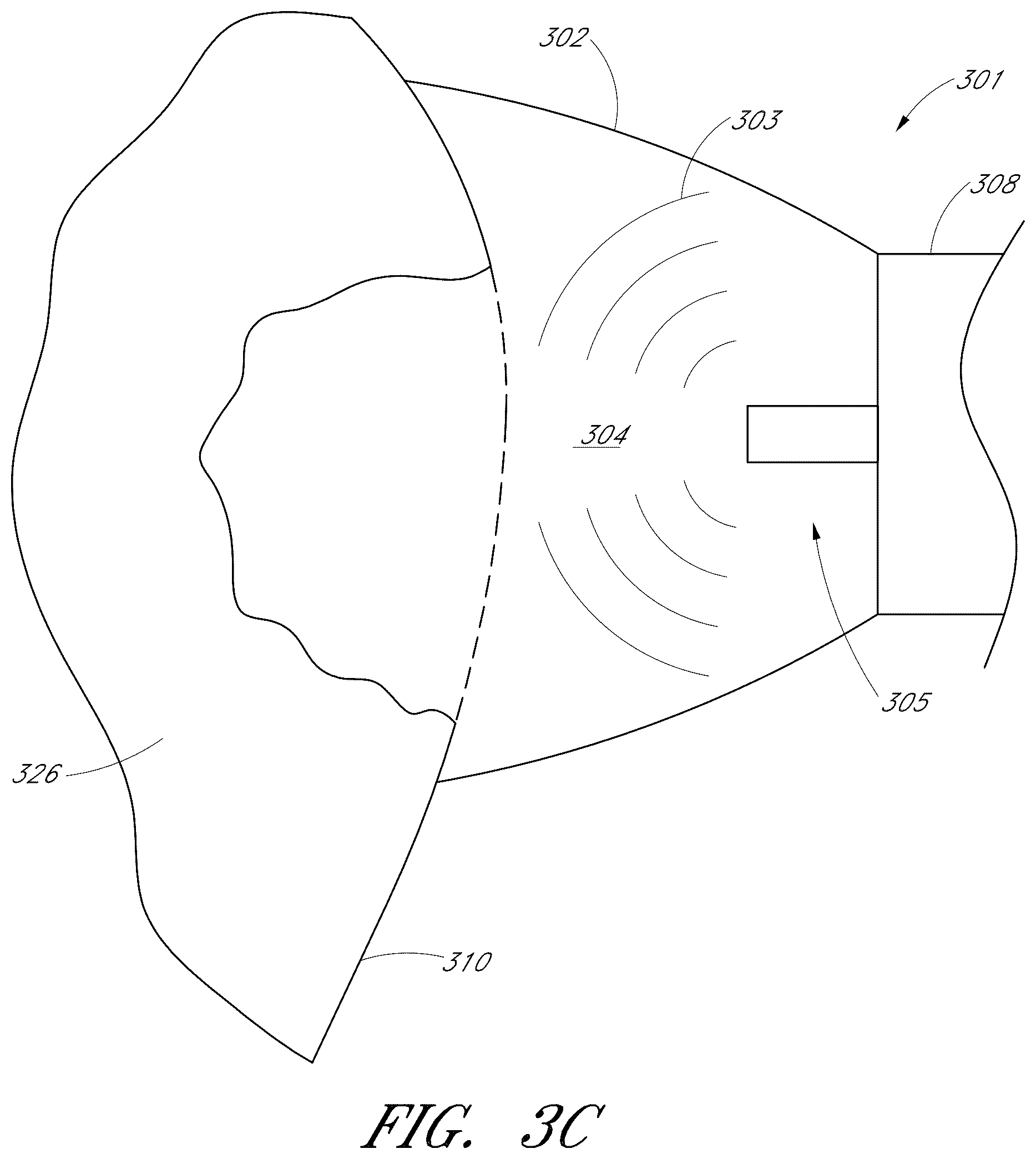 Patent US12551322 Figure 6 – Apparatus and methods for cleaning teeth