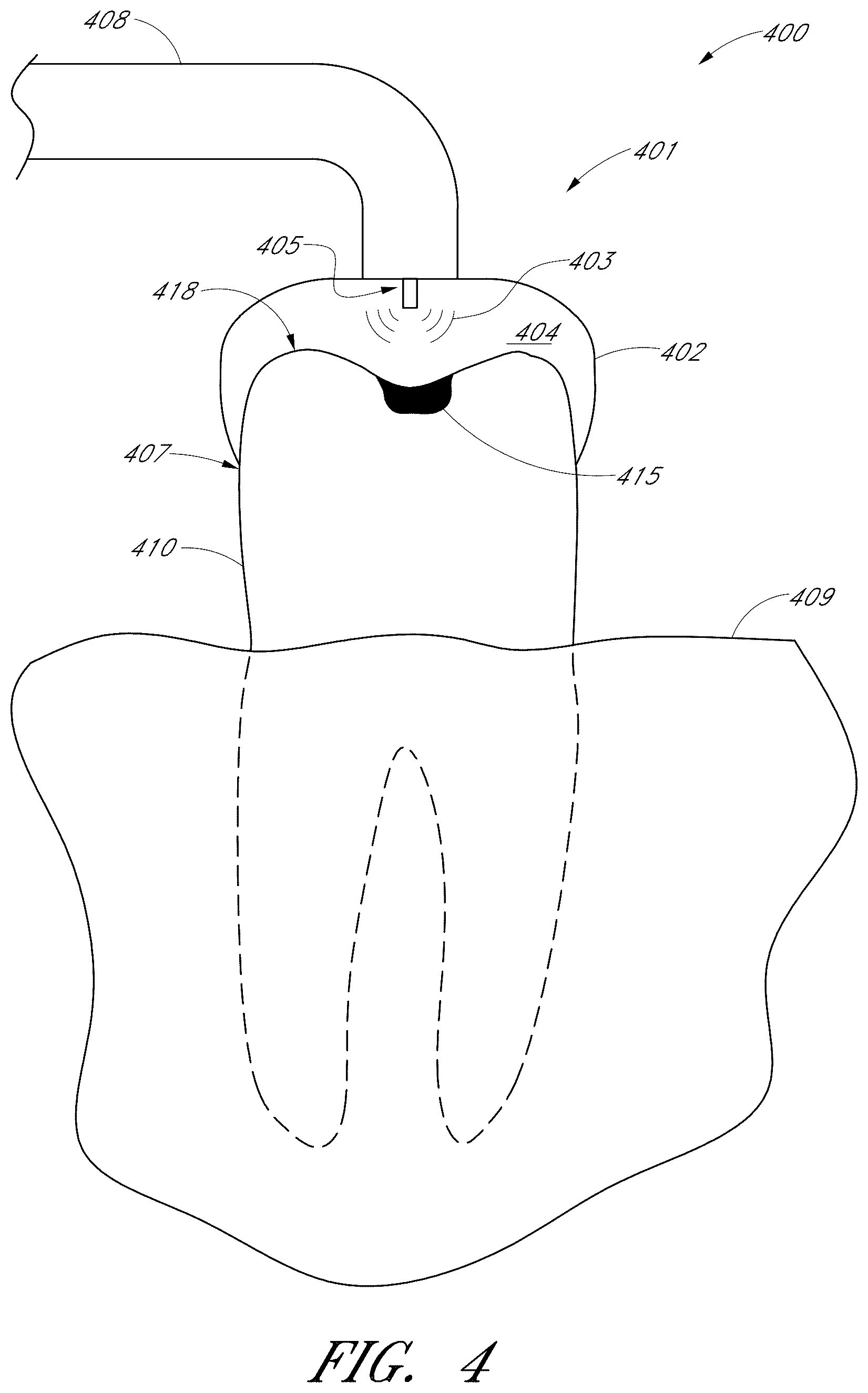 Patent US12551322 Figure 7 – Apparatus and methods for cleaning teeth