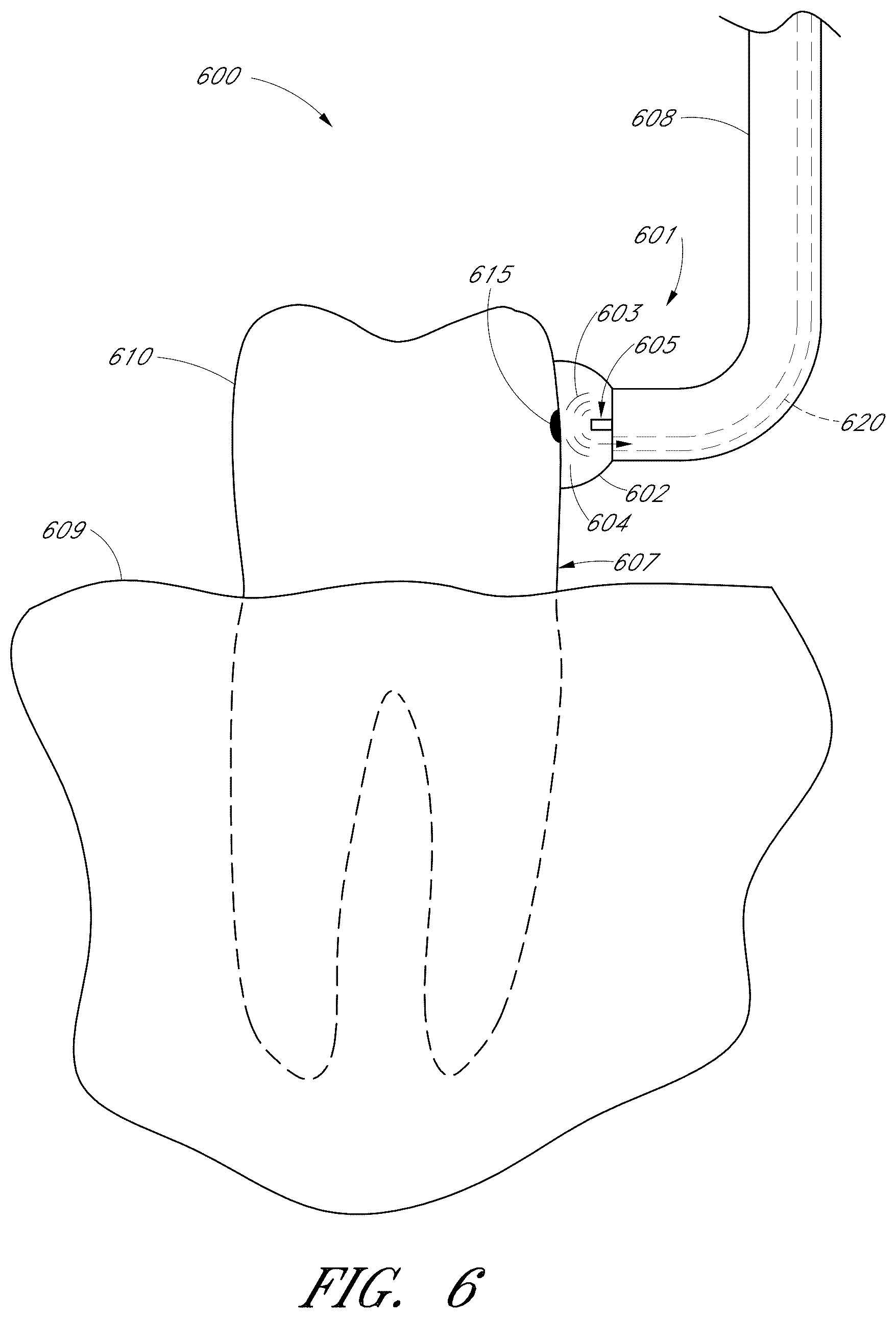 Patent US12551322 Figure 9 – Apparatus and methods for cleaning teeth