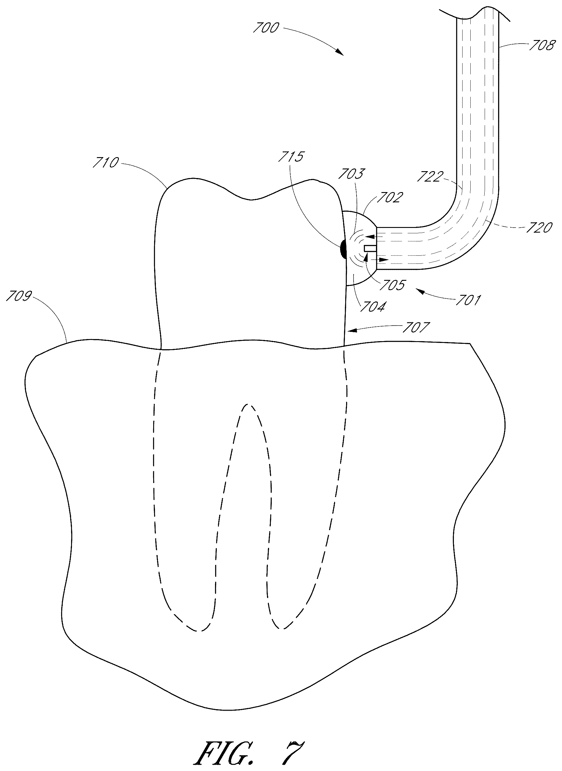 Patent US12551322 Figure 10 – Apparatus and methods for cleaning teeth