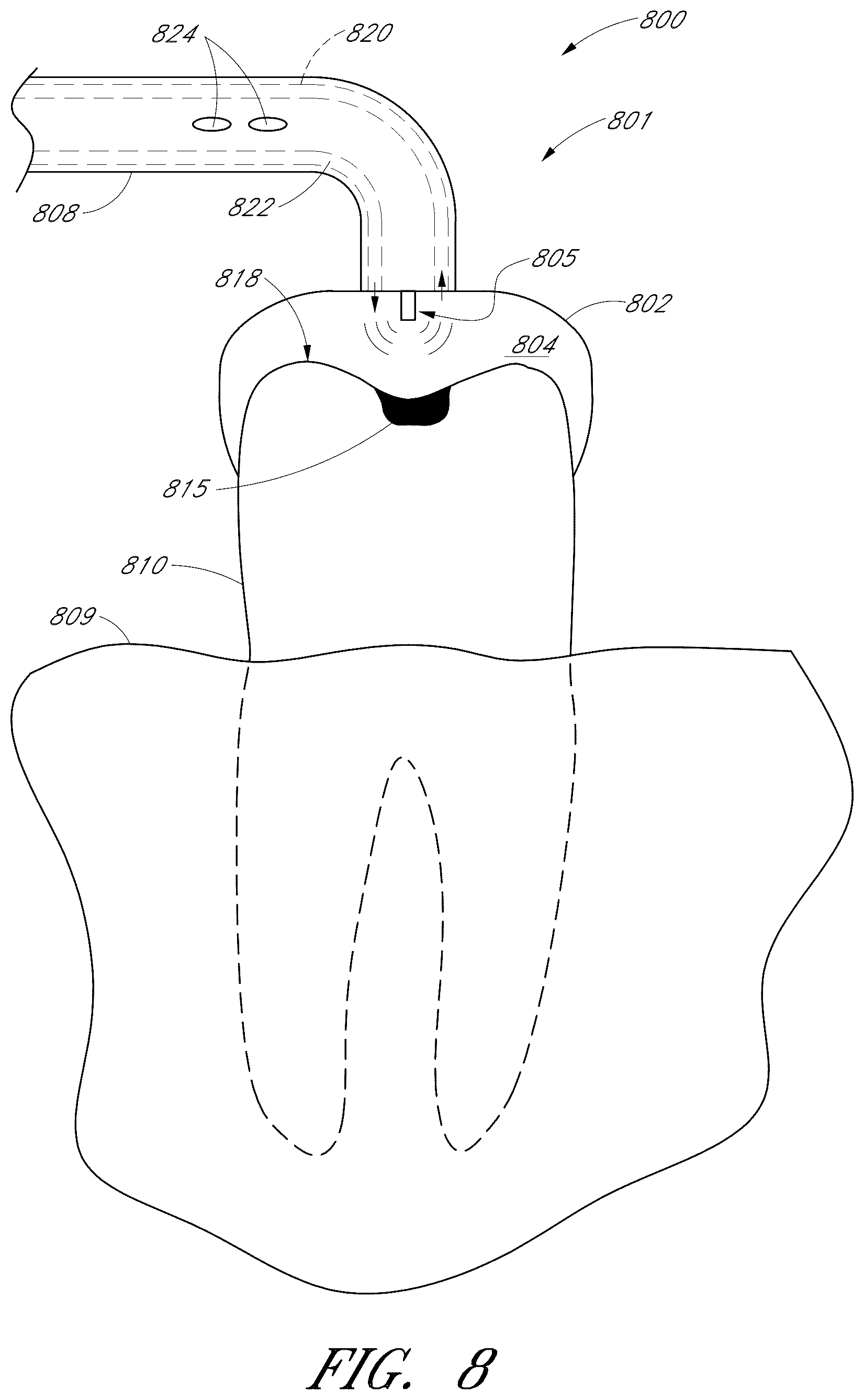Patent US12551322 Figure 11 – Apparatus and methods for cleaning teeth