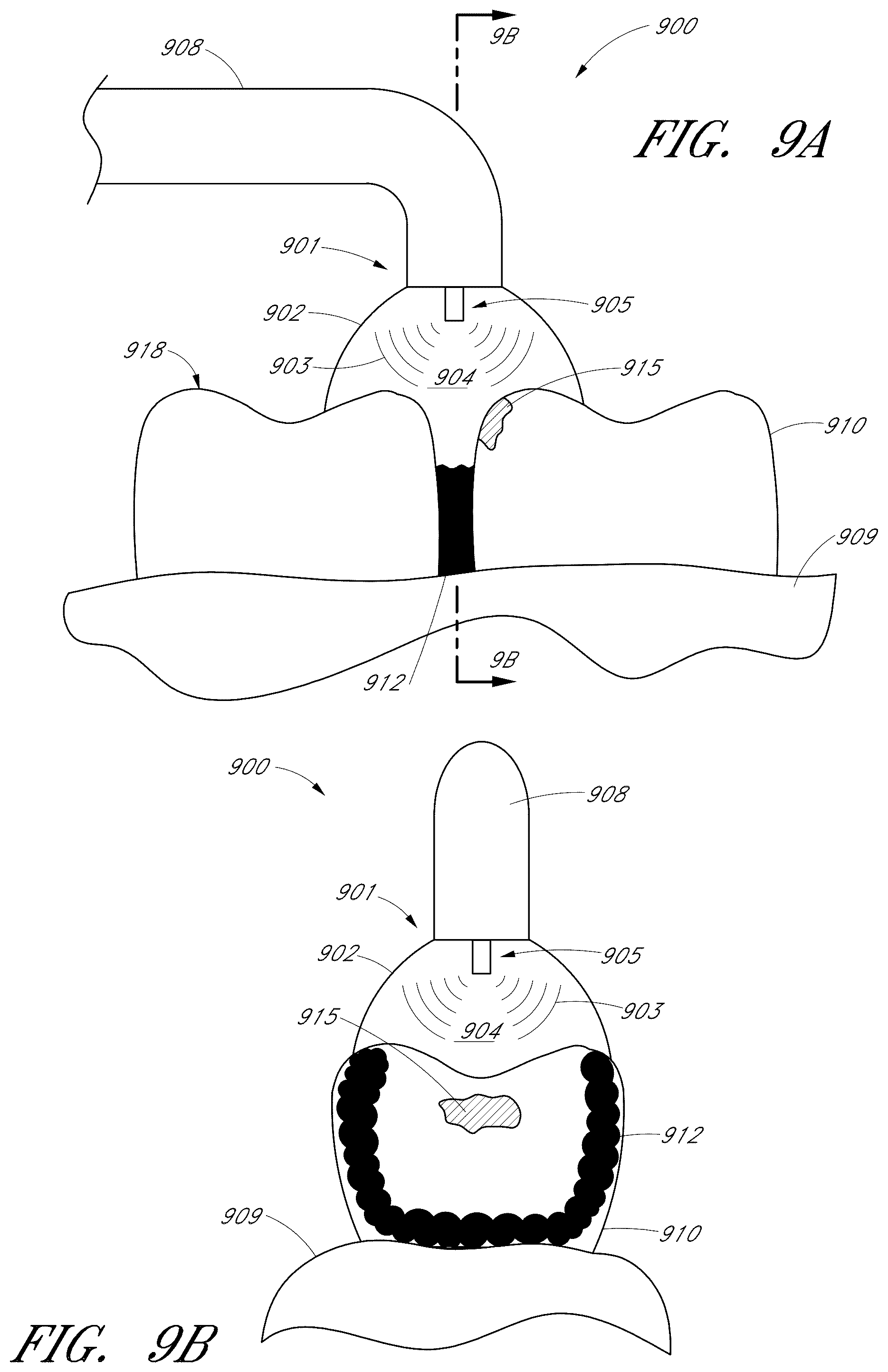Patent US12551322 Figure 12 – Apparatus and methods for cleaning teeth