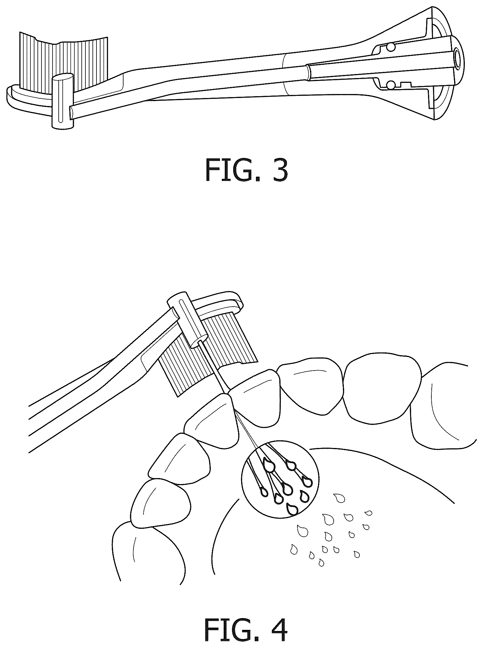 Patent US12551323 Figure 3 – Fluid based tooth cleaning system