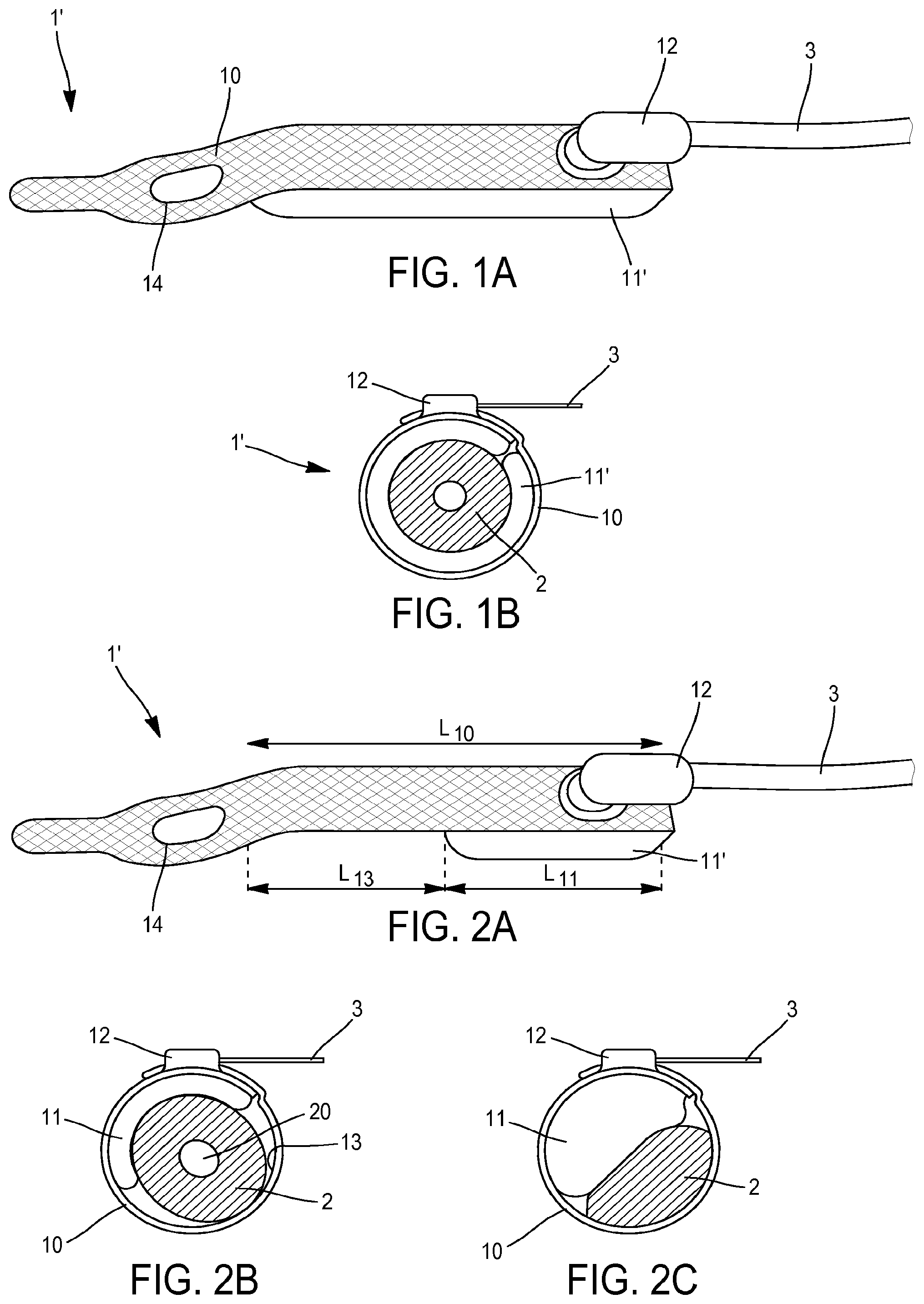 Patent US12551324 Figure 1 – Occlusive cuff and implantable occlusive system comprising such a cuff