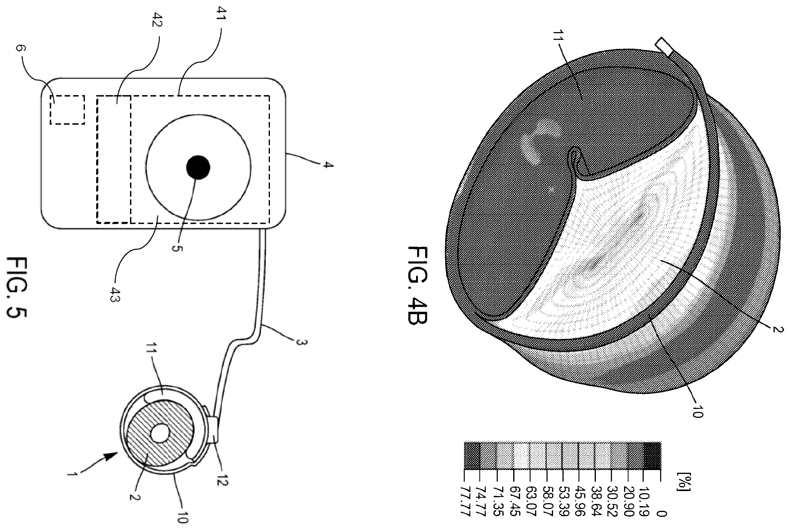 Patent US12551324 Figure 3 – Occlusive cuff and implantable occlusive system comprising such a cuff