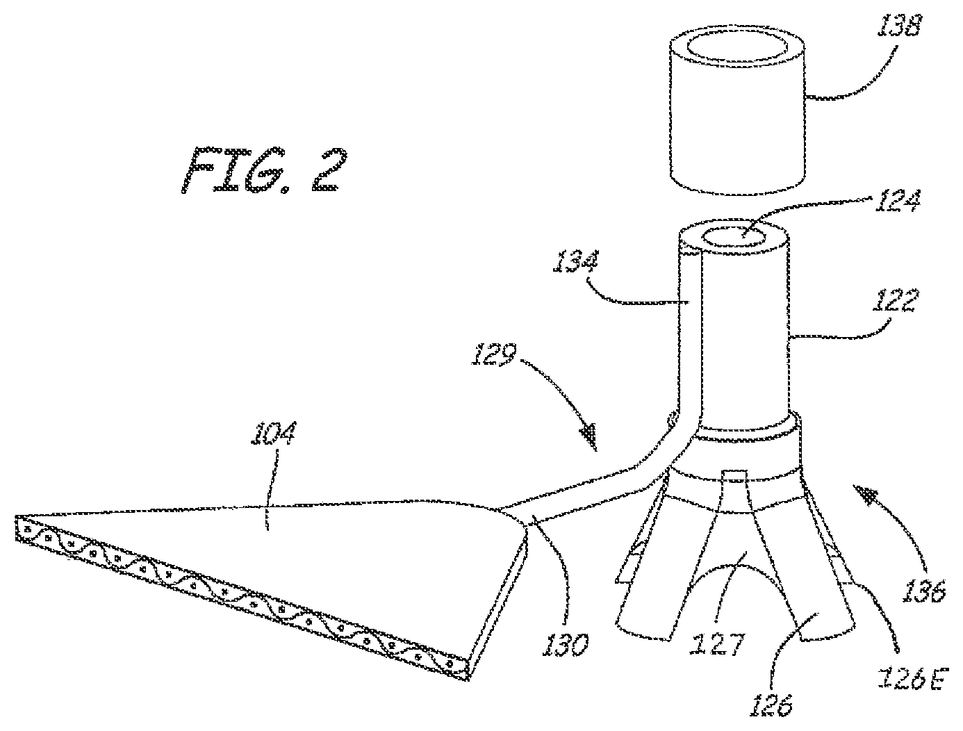 Patent US12551325 Figure 2 – Method of treating urinary incontinence in a patient by placing a sling in a single vaginal incision