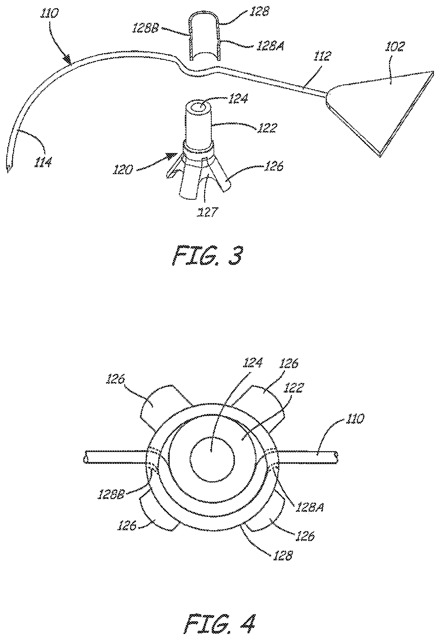 Patent US12551325 Figure 3 – Method of treating urinary incontinence in a patient by placing a sling in a single vaginal incision