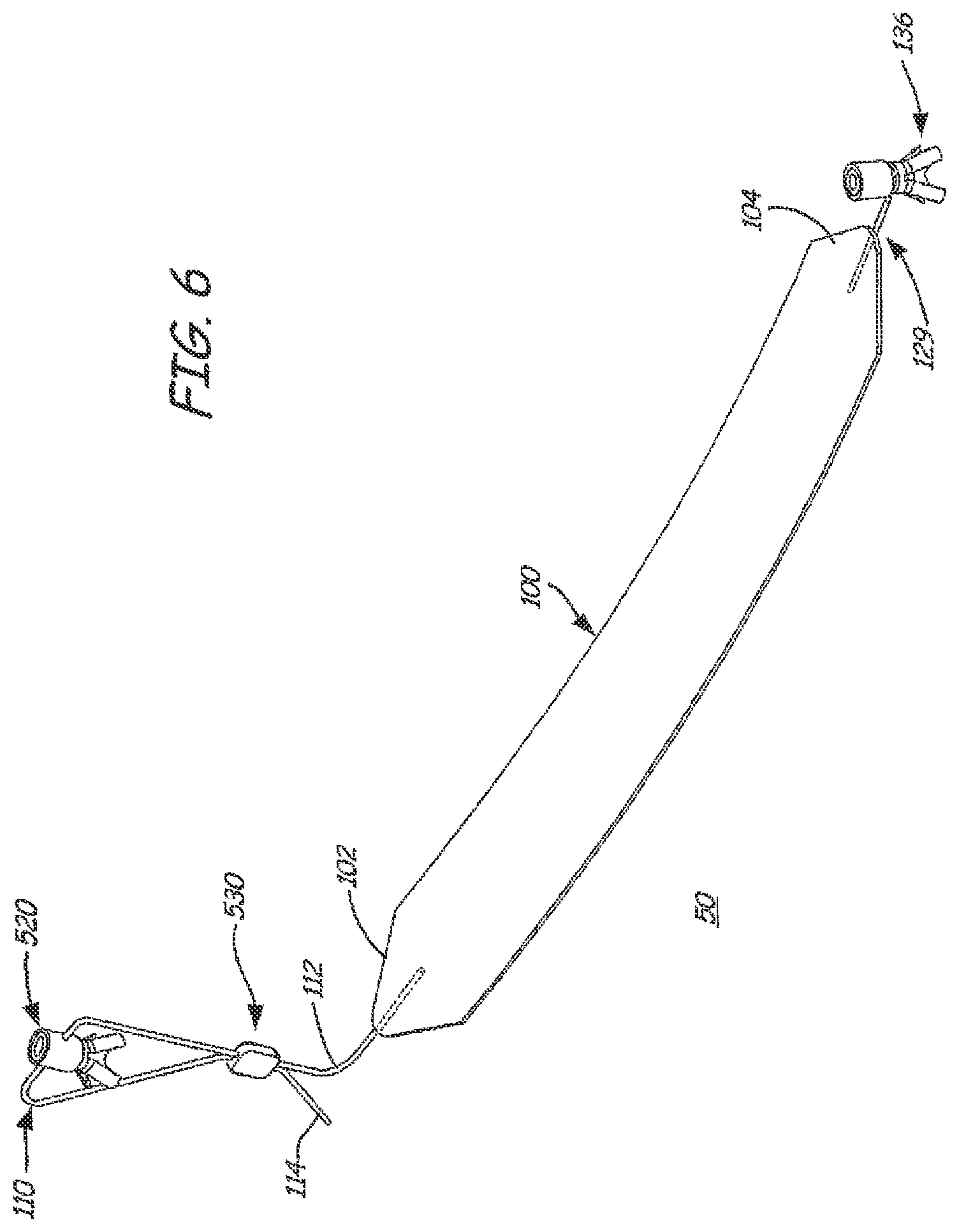 Patent US12551325 Figure 5 – Method of treating urinary incontinence in a patient by placing a sling in a single vaginal incision