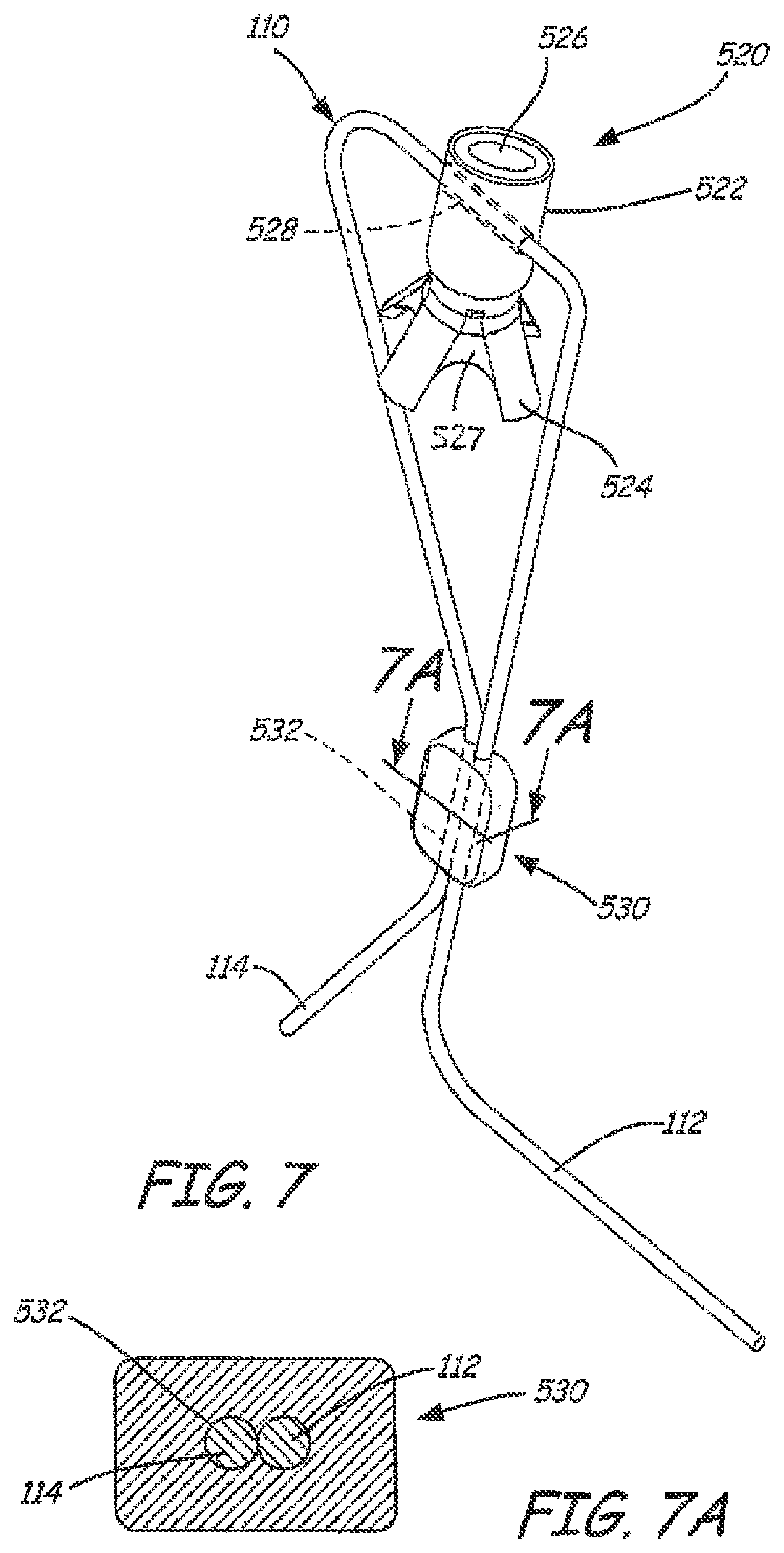 Patent US12551325 Figure 6 – Method of treating urinary incontinence in a patient by placing a sling in a single vaginal incision