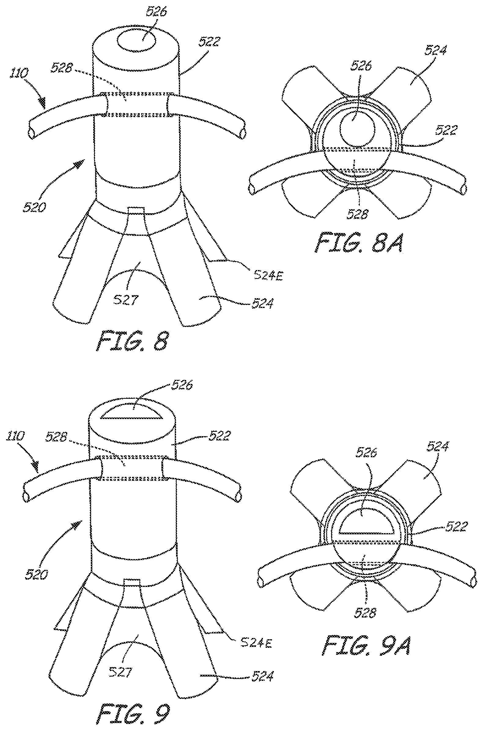 Patent US12551325 Figure 7 – Method of treating urinary incontinence in a patient by placing a sling in a single vaginal incision