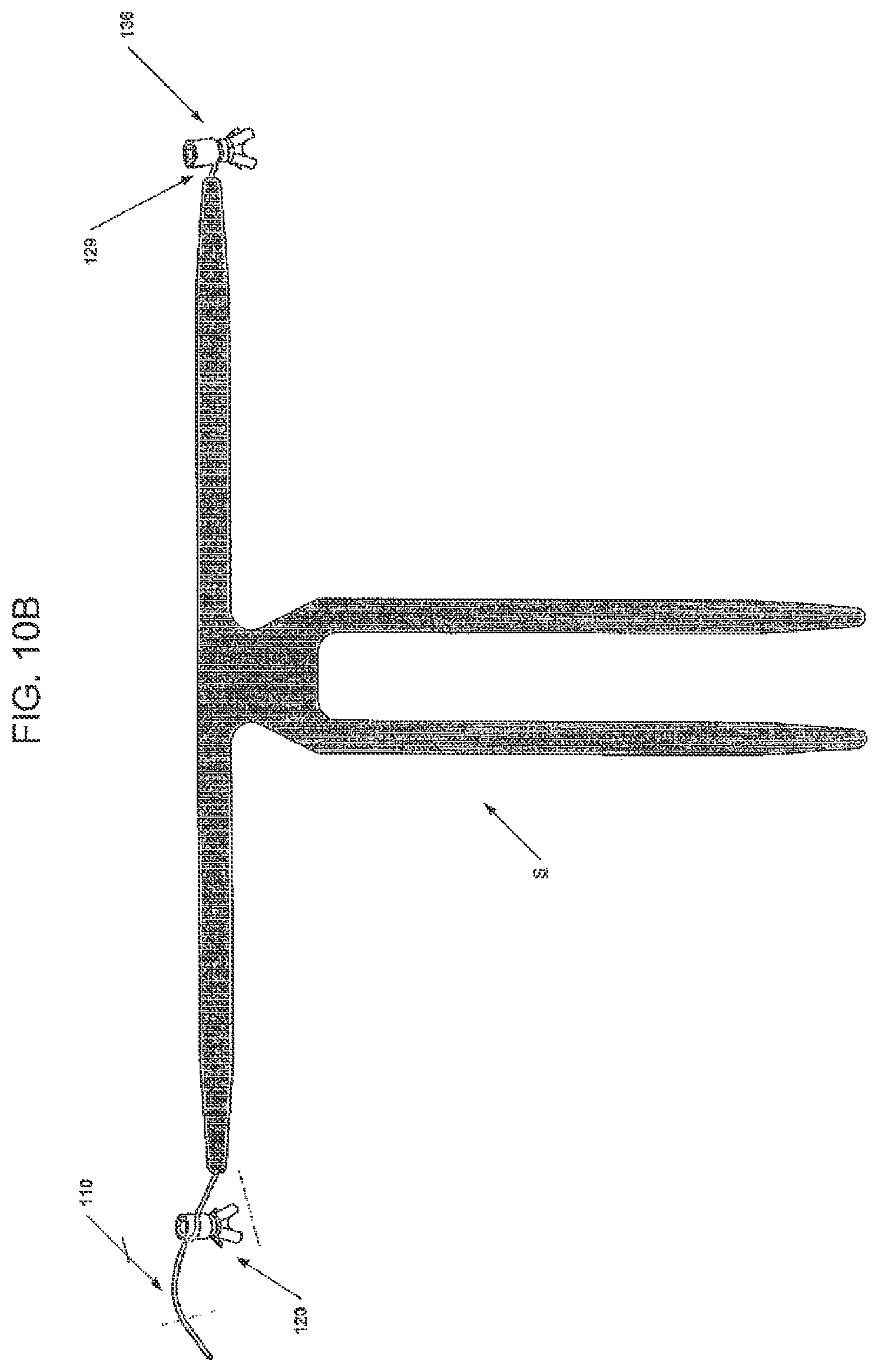 Patent US12551325 Figure 9 – Method of treating urinary incontinence in a patient by placing a sling in a single vaginal incision