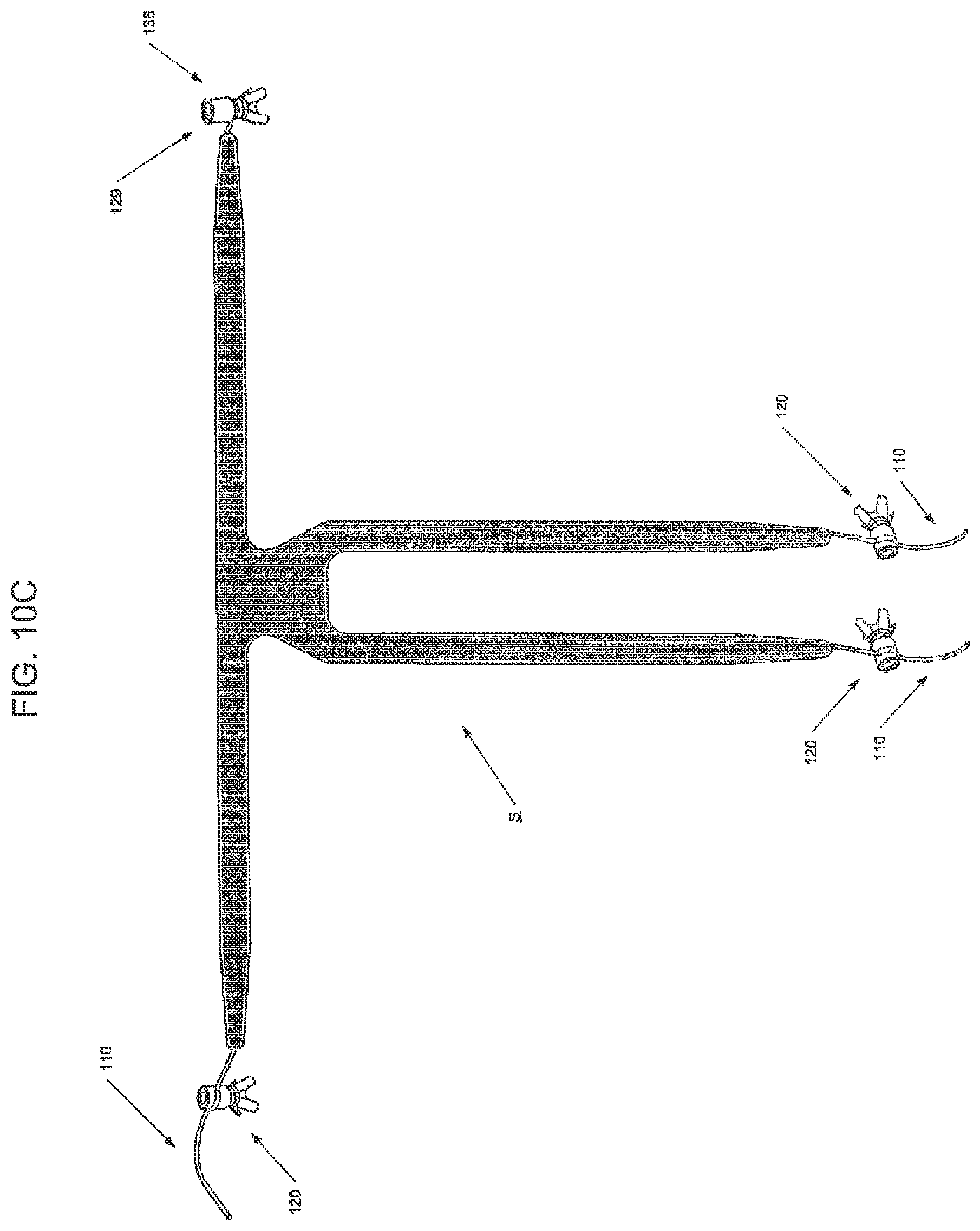 Patent US12551325 Figure 10 – Method of treating urinary incontinence in a patient by placing a sling in a single vaginal incision