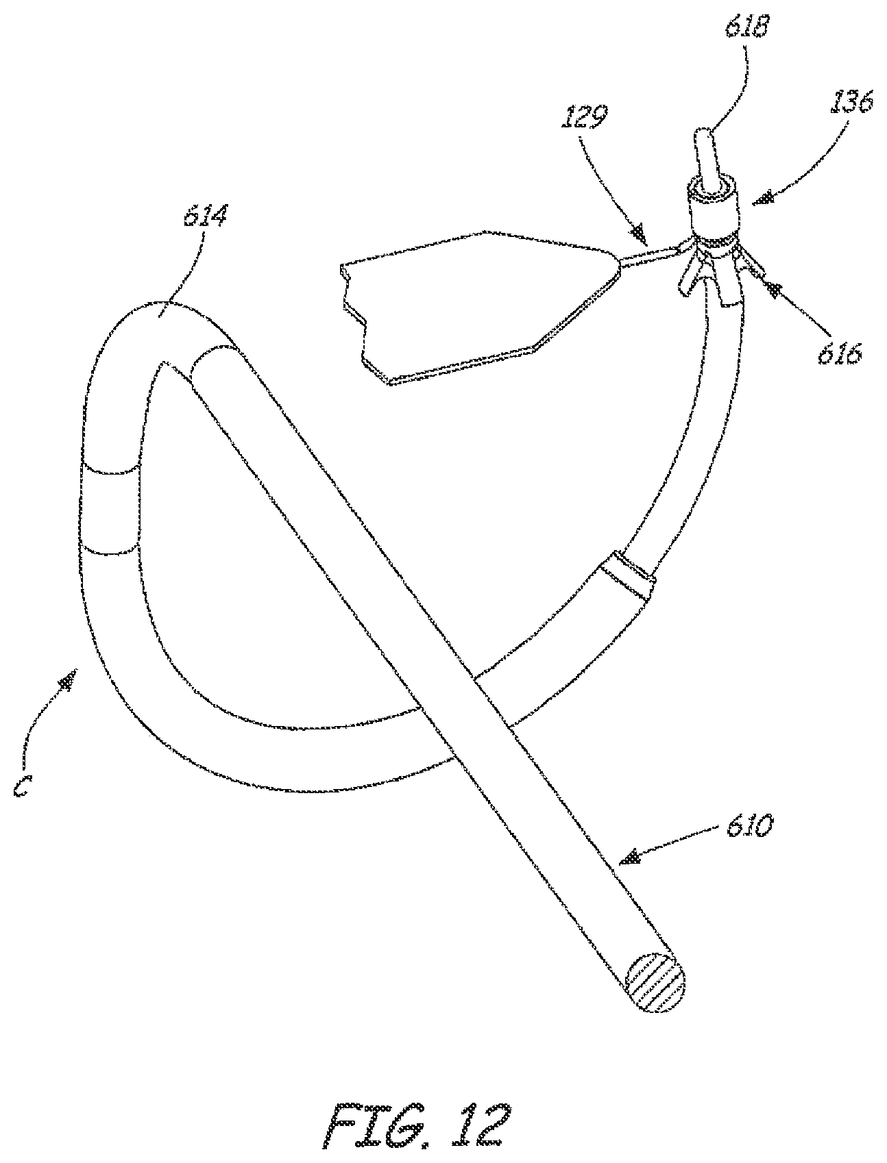 Patent US12551325 Figure 12 – Method of treating urinary incontinence in a patient by placing a sling in a single vaginal incision