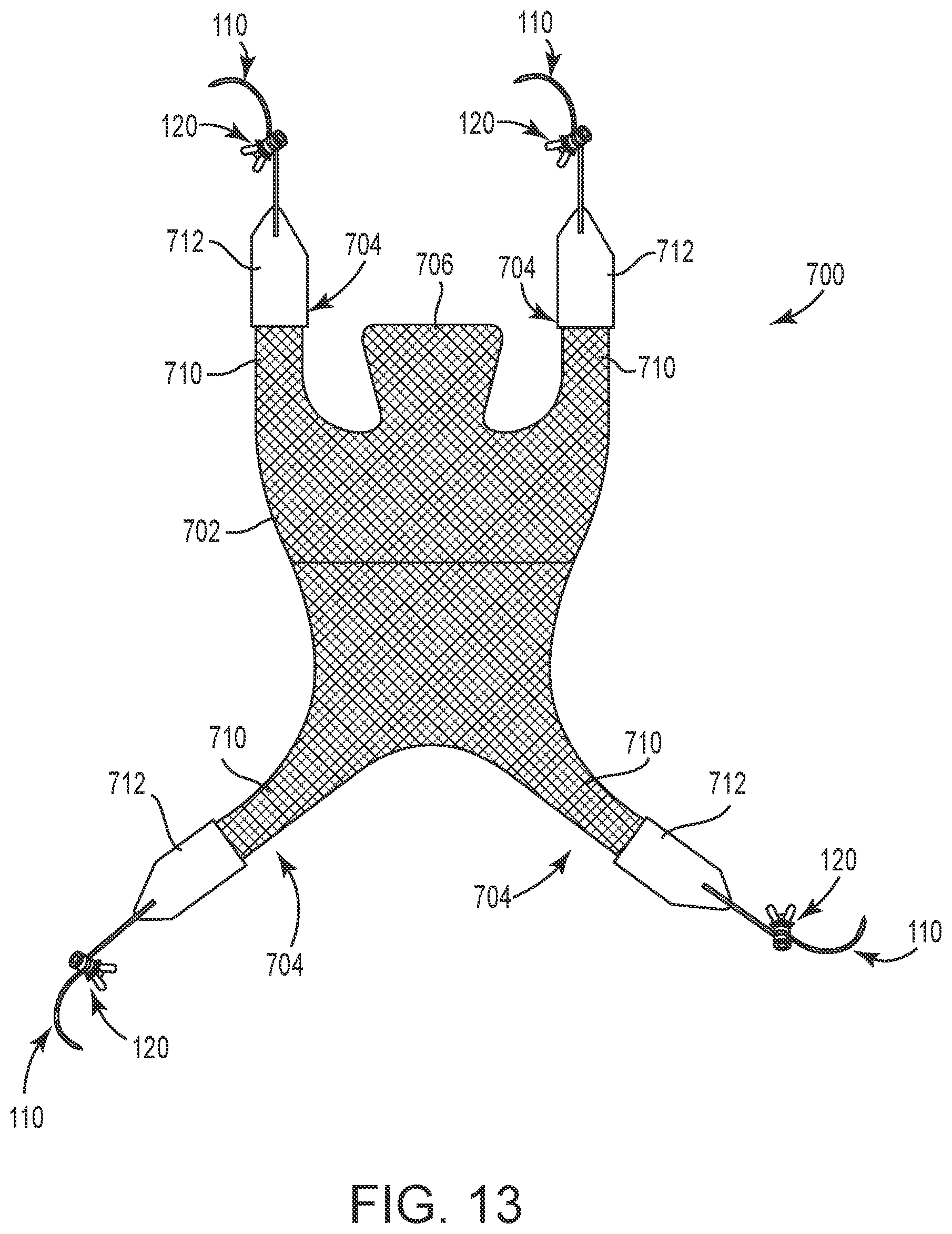 Patent US12551325 Figure 13 – Method of treating urinary incontinence in a patient by placing a sling in a single vaginal incision