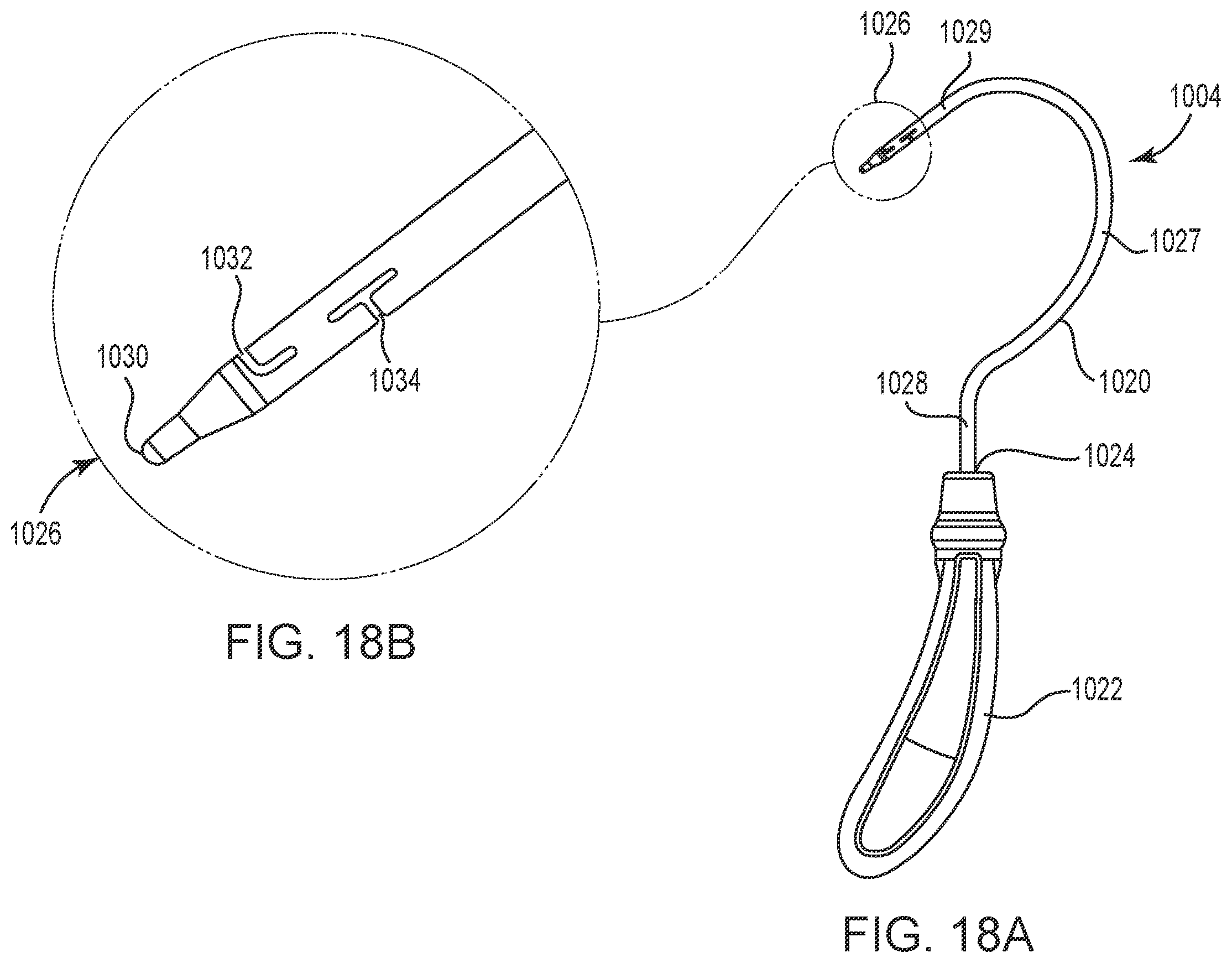 Patent US12551325 Figure 18 – Method of treating urinary incontinence in a patient by placing a sling in a single vaginal incision