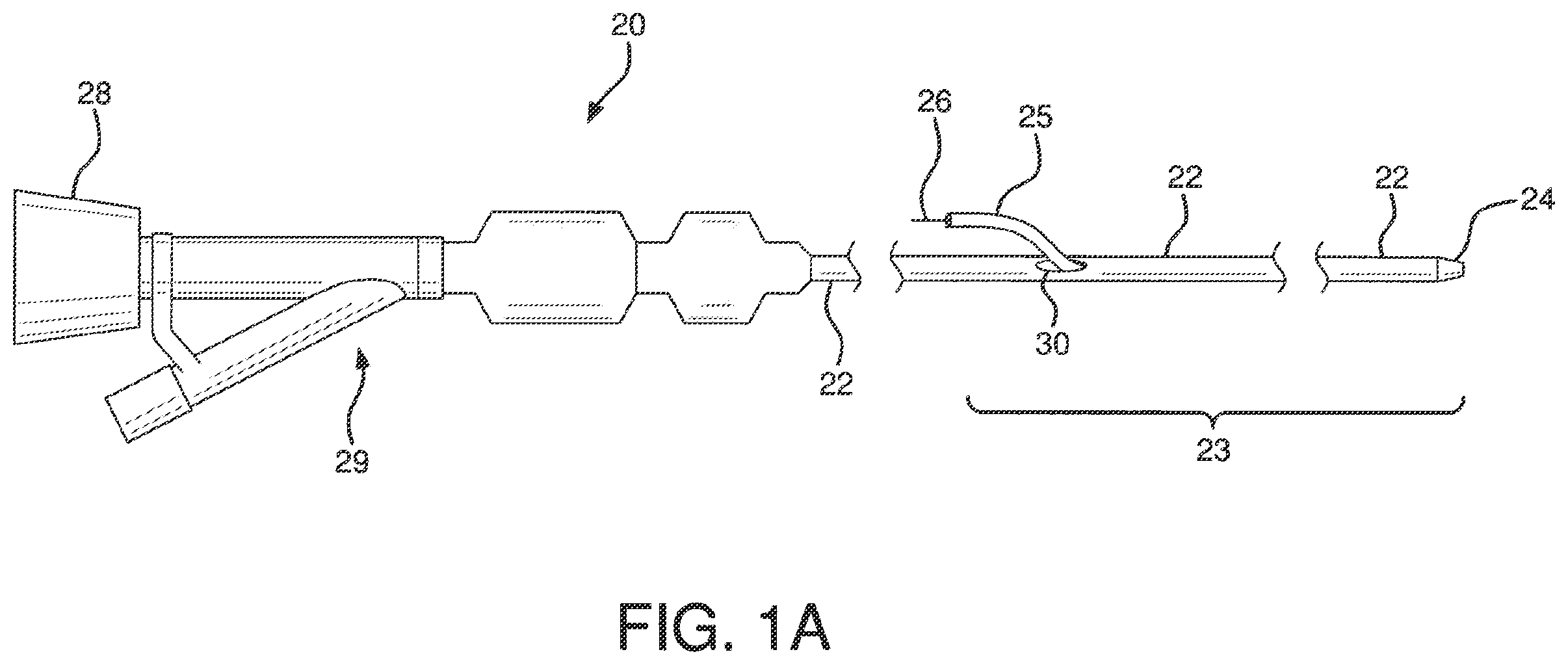 Patent US12551326 Figure 1 – Retrieval catheter
