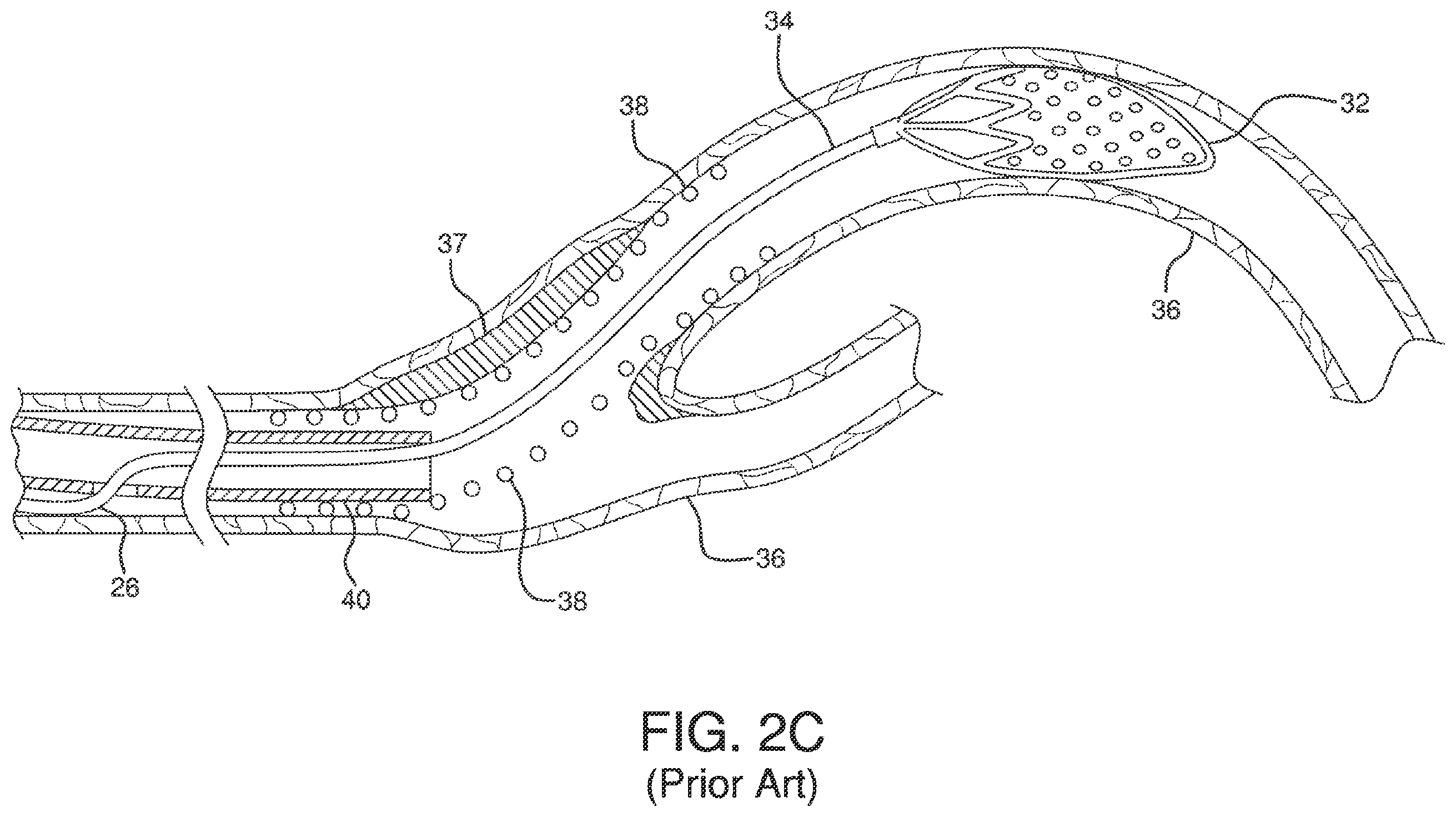 Patent US12551326 Figure 8 – Retrieval catheter