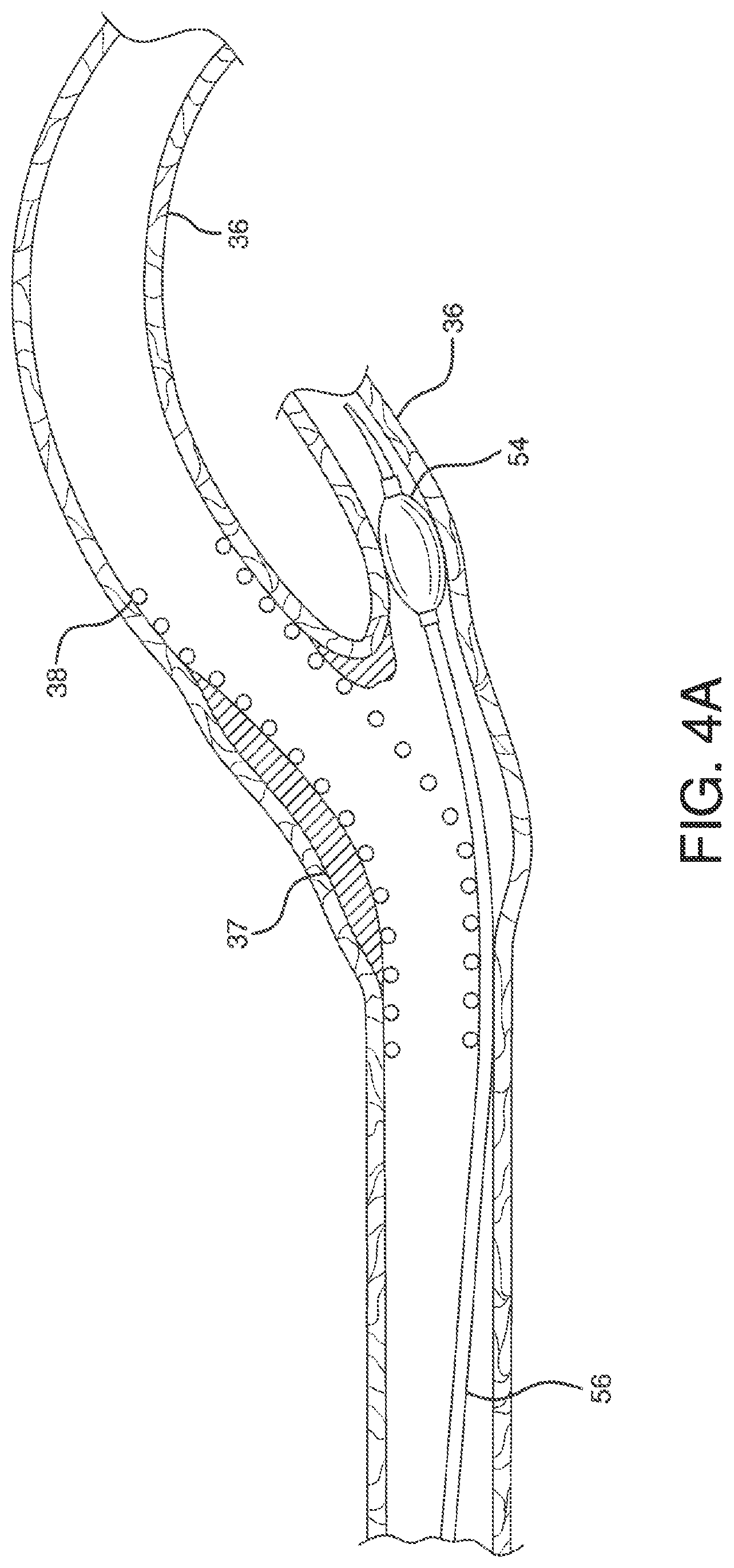 Patent US12551326 Figure 13 – Retrieval catheter