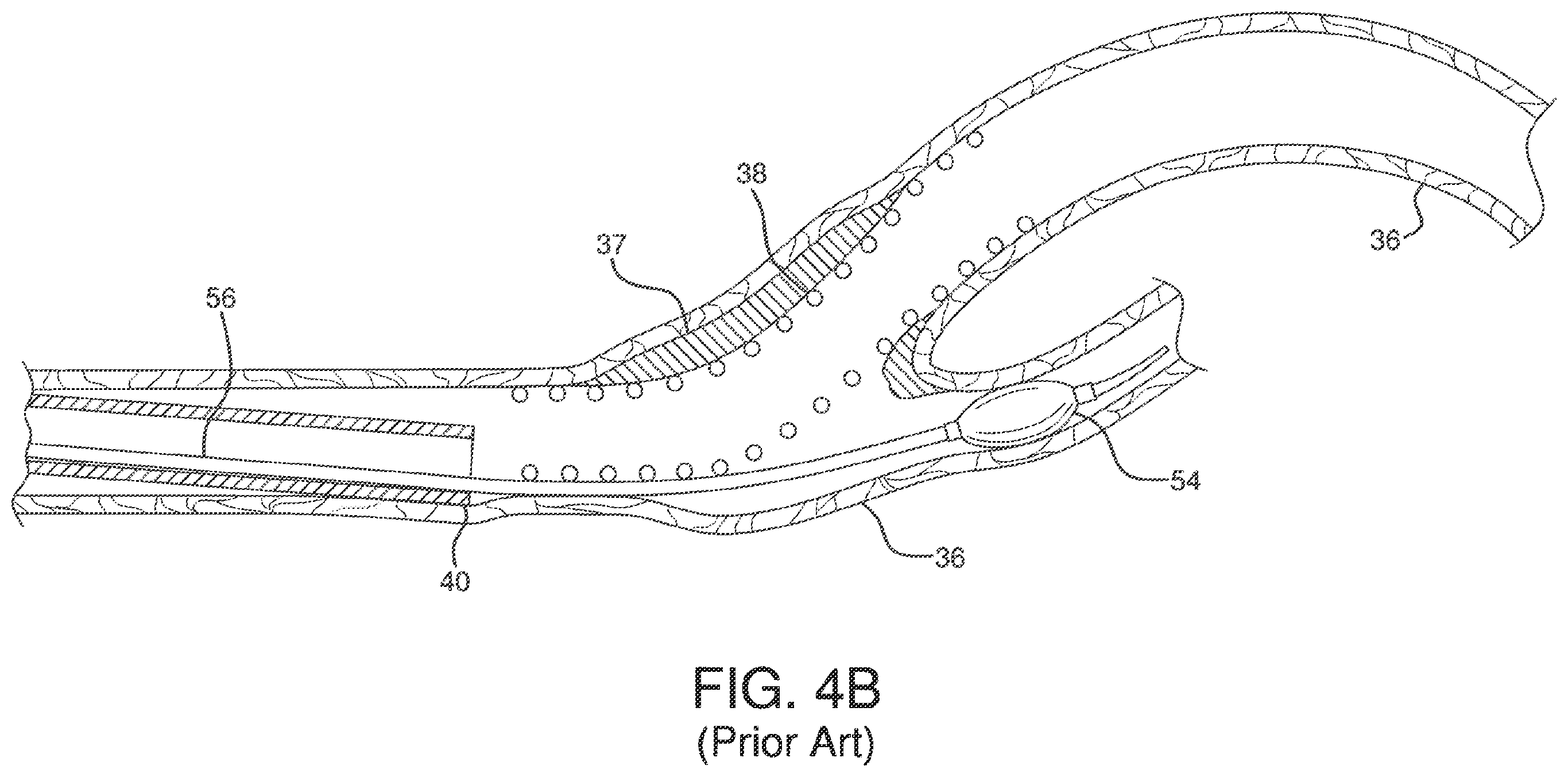 Patent US12551326 Figure 14 – Retrieval catheter