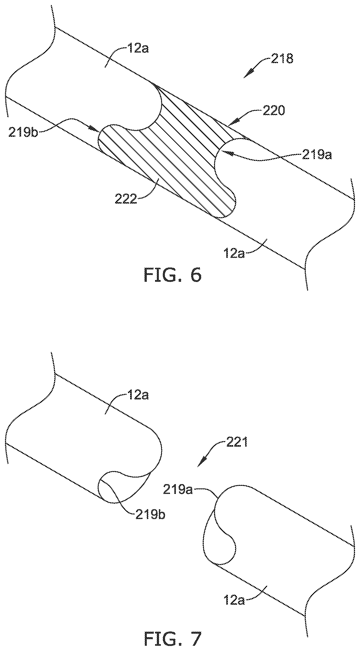 Patent US12551327 Figure 6 – Biodegradable stent