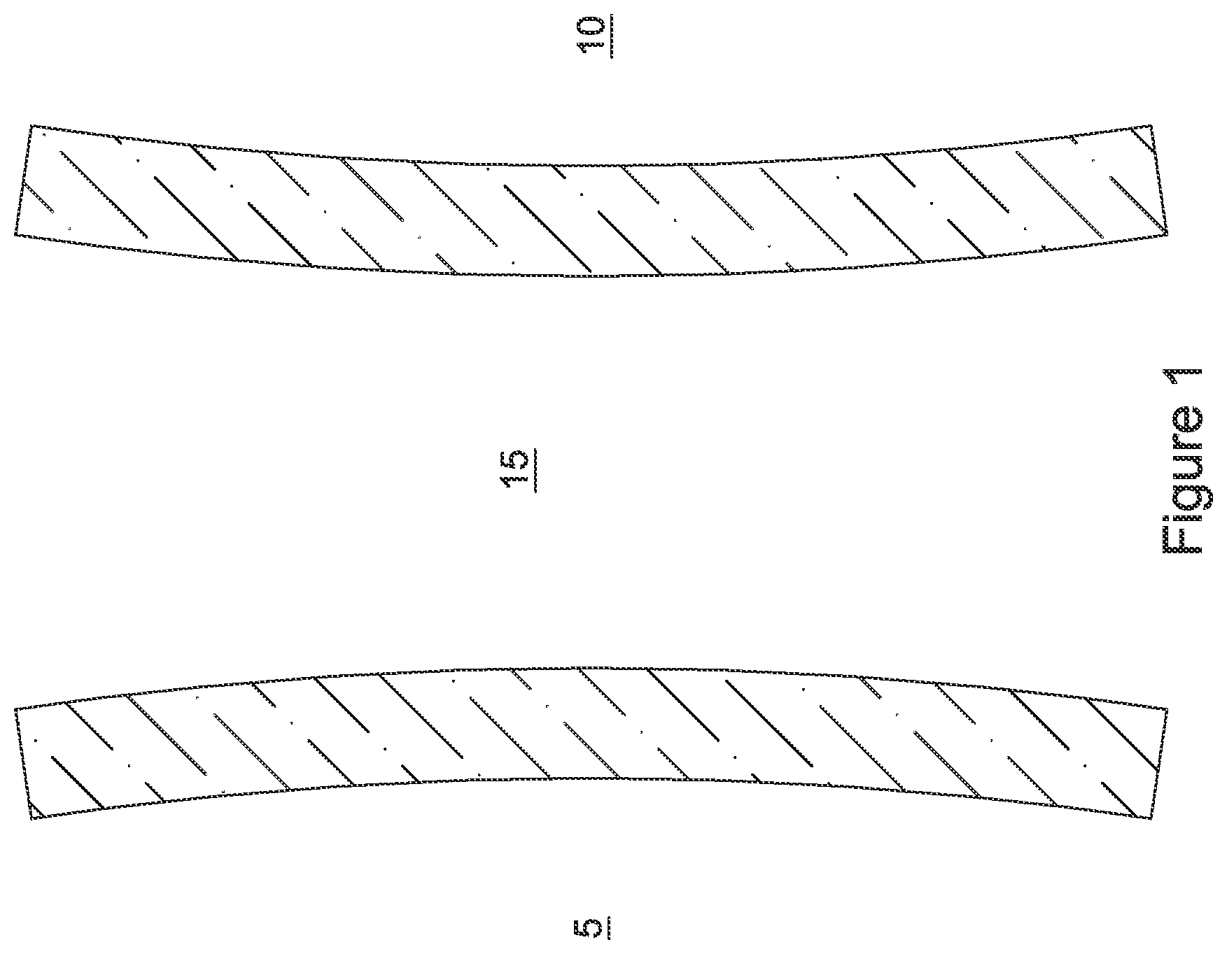 Patent US12551328 Figure 1 – Device for anastomotic bypass