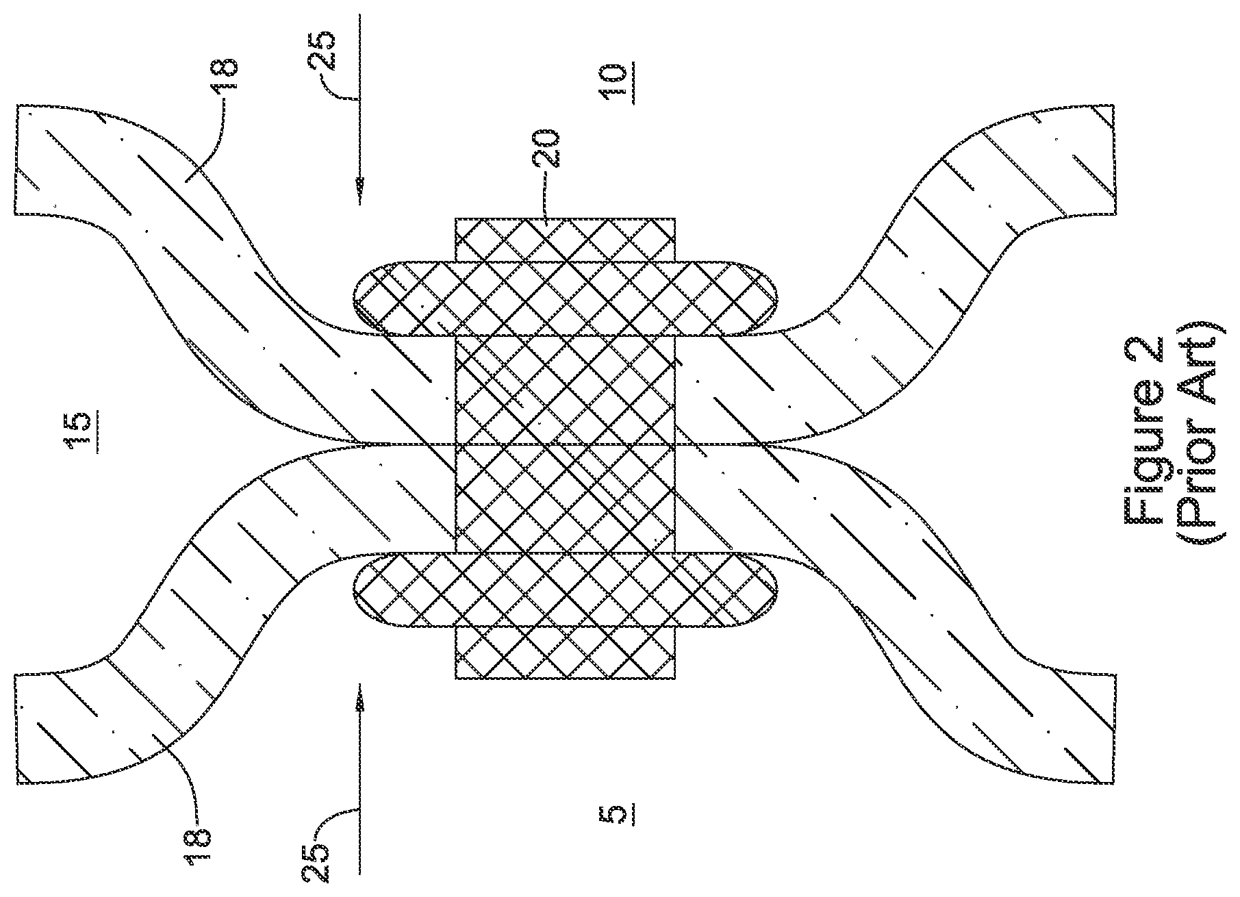 Patent US12551328 Figure 2 – Device for anastomotic bypass