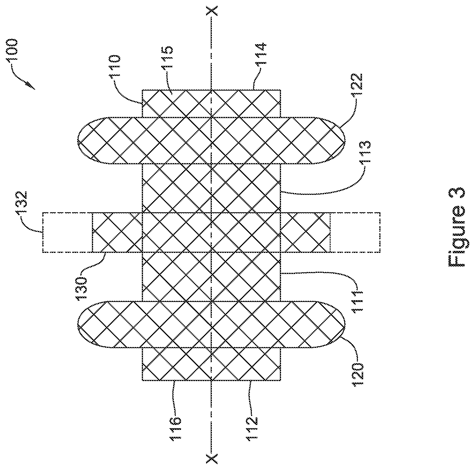 Patent US12551328 Figure 3 – Device for anastomotic bypass