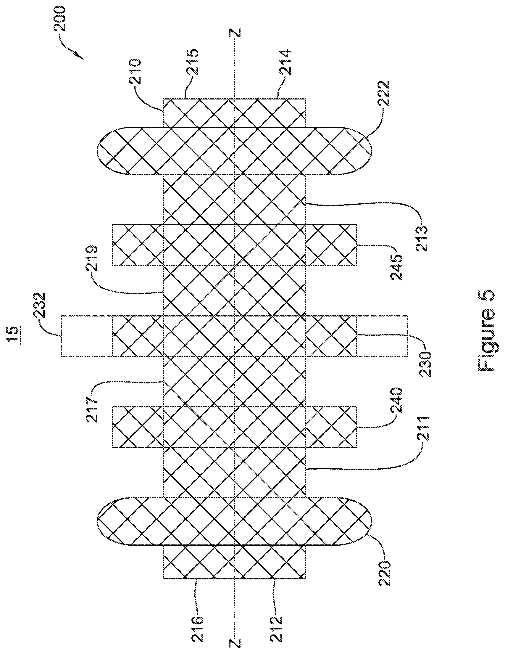 Patent US12551328 Figure 5 – Device for anastomotic bypass