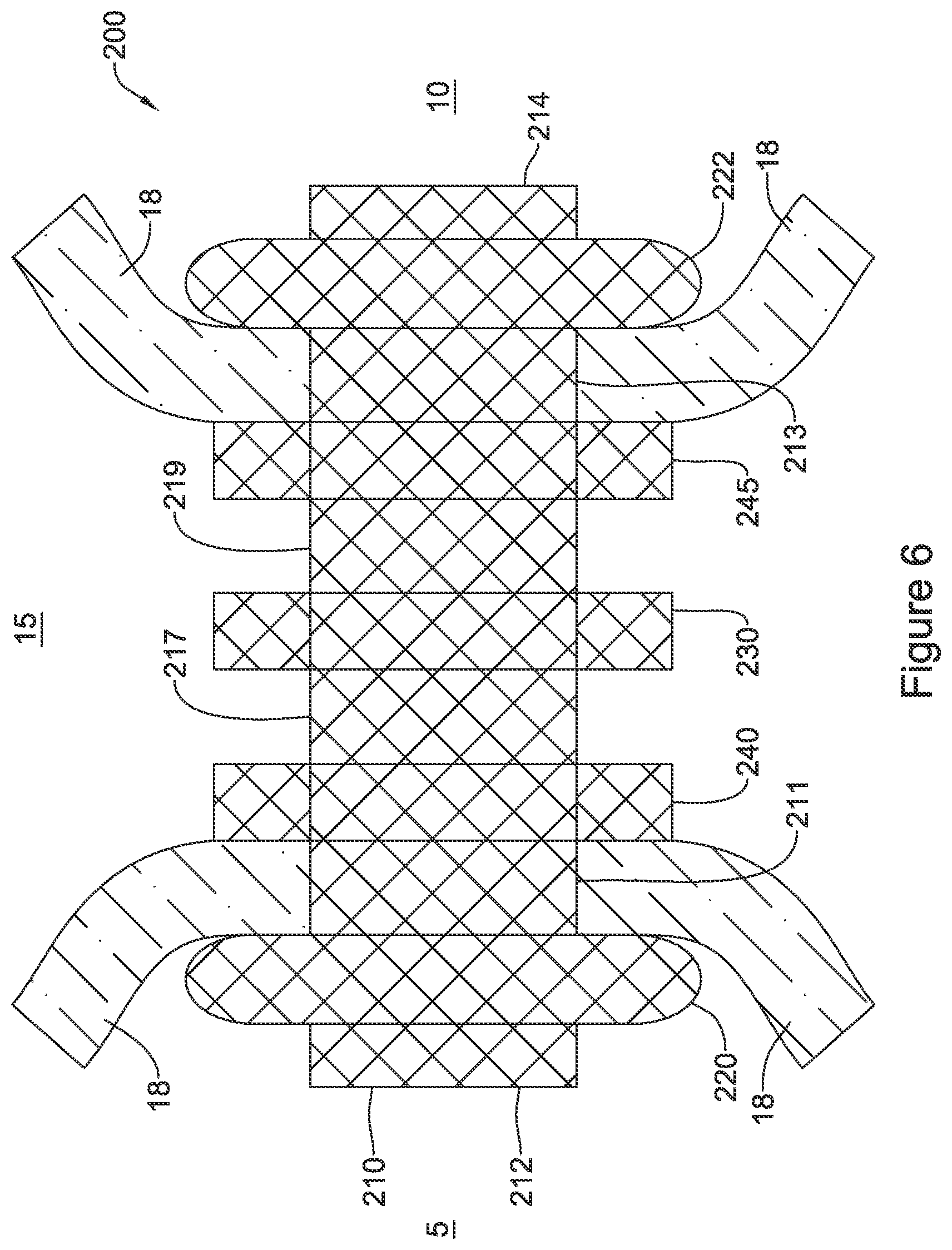 Patent US12551328 Figure 6 – Device for anastomotic bypass