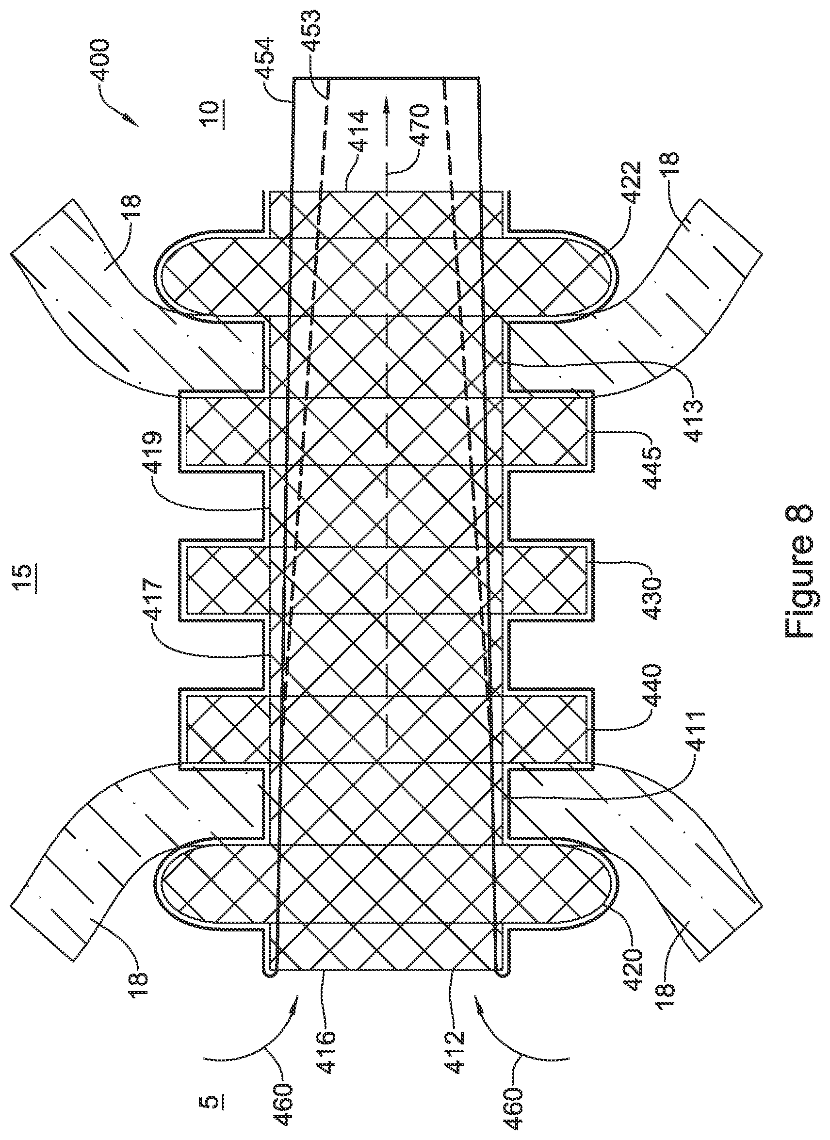 Patent US12551328 Figure 9 – Device for anastomotic bypass