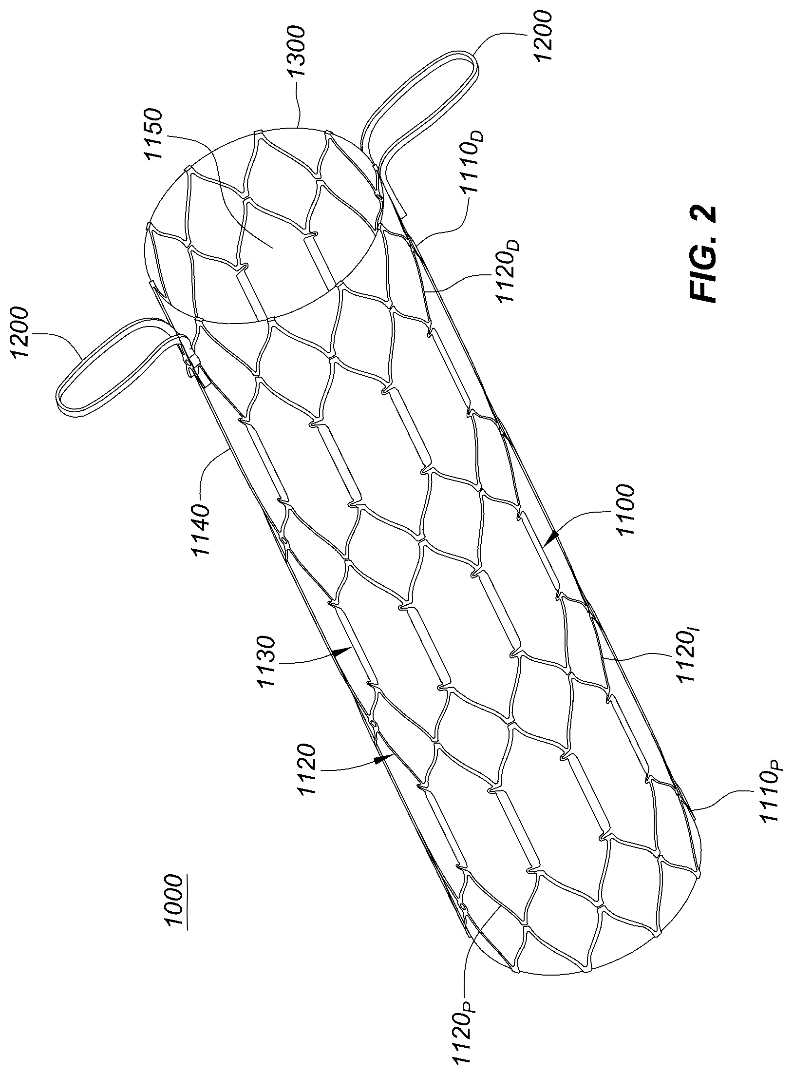 Patent US12551329 Figure 5 – Transcatheter growth devices and methods for Norwood, Glenn and Fontan therapy
